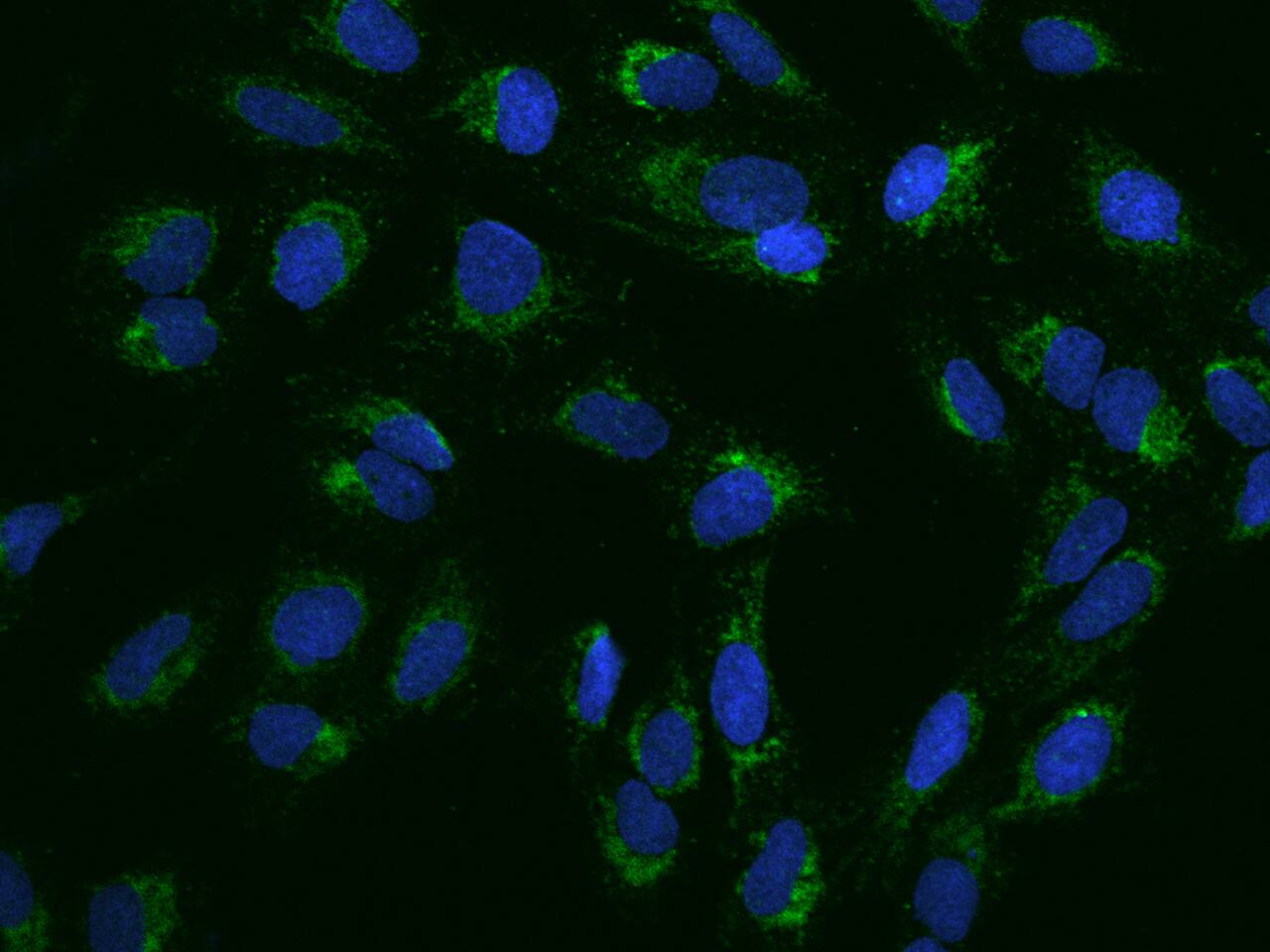 Immunocytochemistry/Immunofluorescence: PNPT1 Antibody [NBP2-97714] - Immunofluorescence staining of PNPT1 in U2OS cells. Cells were fixed with 4% PFA, permeabilzed with 0.1% Triton X-100 in PBS, blocked with 10% serum, and incubated with NBP2-97714 antibody (dilution ratio 1:200) at 4C overnight. Then cells were stained with the Alexa Fluor(R)488-conjugated Goat Anti-rabbit IgG secondary antibody (green) and counterstained with DAPI (blue).Positive staining was localized to Cytoplasm.