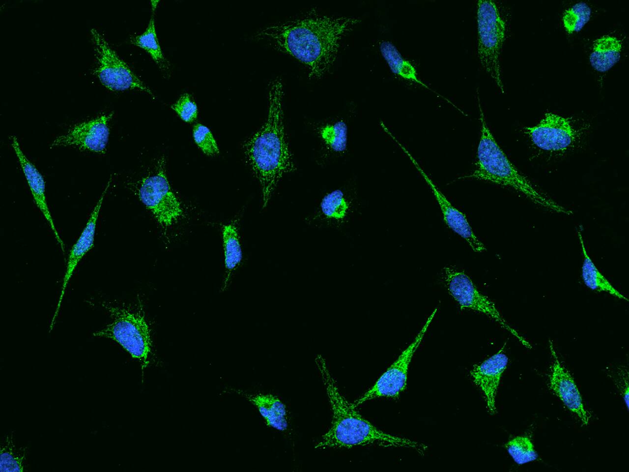 Immunocytochemistry/Immunofluorescence: HMGCS1 Antibody [NBP2-97737] - Immunofluorescence staining of HMGCS1 in Hela cells. Cells were fixed with 4% PFA, permeabilzed with 0.1% Triton X-100 in PBS, blocked with 10% serum, and incubated with NBP2-97737 antibody (dilution ratio 1:200) at 4C overnight. Then cells were stained with the Alexa Fluor(R)488-conjugated Goat Anti-rabbit IgG secondary antibody (green) and counterstained with DAPI (blue).Positive staining was localized to Cytoplasm.
