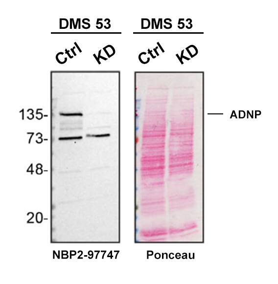 <b>Genetic Strategies Validation. </b>Western blot shows lysates of DMS 53 parental cell line and ADNP knockdown DMS 53 cell line (KD). Nitrocellulose membrane was probed with ADNP Antibody (Catalog # NBP2-97747) followed by HRP-conjugated secondary antibody. A specific band was detected for ADNP at approximately 135 kDa (as indicated) in the parental DMS 53 cell line, but is significantly reduced in the DMS 53 cell line. Primary antibody dilution used: 1/1000. The Ponceau stained transfer of the blot is shown. This experiment was conducted under reducing conditions. Image, protocol, and testing courtesy of YCharOS Inc. See ycharos.com for additional details.