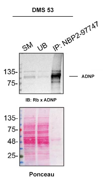 DMS 53 cell line lysates were prepared and immunoprecipitation was performed using 2.0 μg of ADNP Antibody (Catalog # NBP2-97747) pre-coupled to Dynabeads Protein A. Immunoprecipitated ADNP was detected in Western Blot with a Rabbit ADNP antibody used at 1/500. The Ponceau stained transfer of the blot is shown. SM=4% starting material; UB=4% unbound fraction; IP=immunoprecipitate; HC=antibody heavy chain. Image, protocol and testing courtesy of YCharOS Inc. (ycharos.com).
