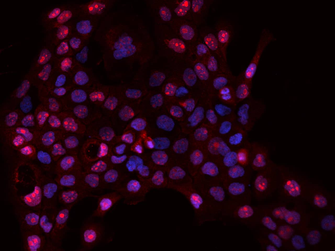 Immunocytochemistry/Immunofluorescence: DNTTIP2 Antibody [NBP2-97758] - Immunofluorescence staining of DNTTIP2 in A431 cells. Cells were fixed with 4% PFA, permeabilzed with 0.1% Triton X-100 in PBS, blocked with 10% serum, and incubated with NBP2-97758 antibody (dilution ratio 1:200) at 4C overnight. Then cells were stained with the Alexa Fluor(R)594-conjugated Goat Anti-rabbit IgG Secondary antibody (red) and counterstained with DAPI (blue).Positive staining was localized to Nucleolus.