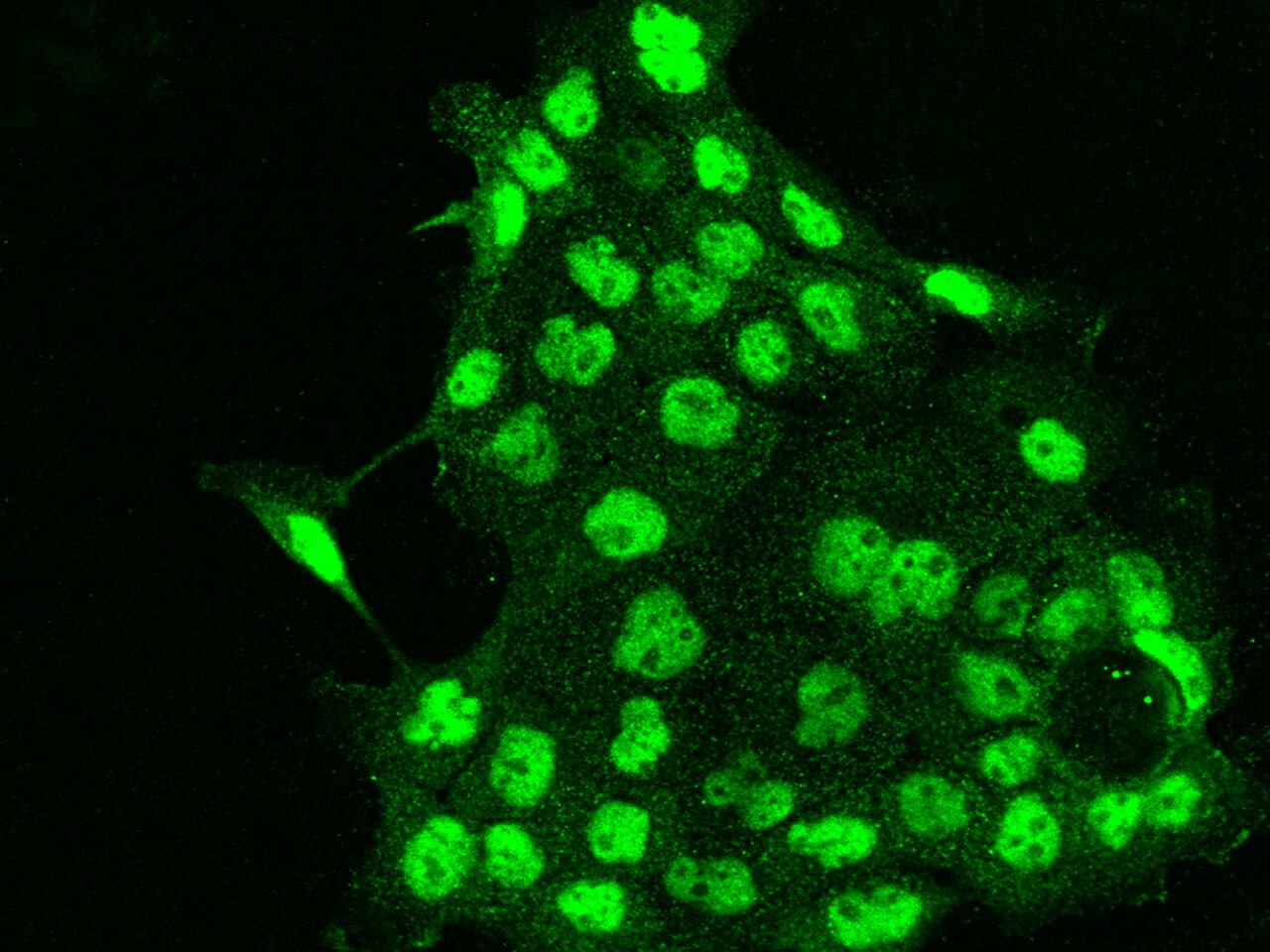 Immunocytochemistry/Immunofluorescence: RBM7 Antibody [NBP2-97836] - Immunofluorescence staining of RBM7 in A431 cells. Cells were fixed with 4% PFA, permeabilzed with 0.1% Triton X-100 in PBS, blocked with 10% serum, and incubated with NBP2-97836 antibody (dilution ratio 1:200) at 4C overnight. Then cells were stained with the Alexa Fluor(R)488-conjugated Goat Anti-rabbit IgG secondary antibody (green). Positive staining was localized to Nucleus.