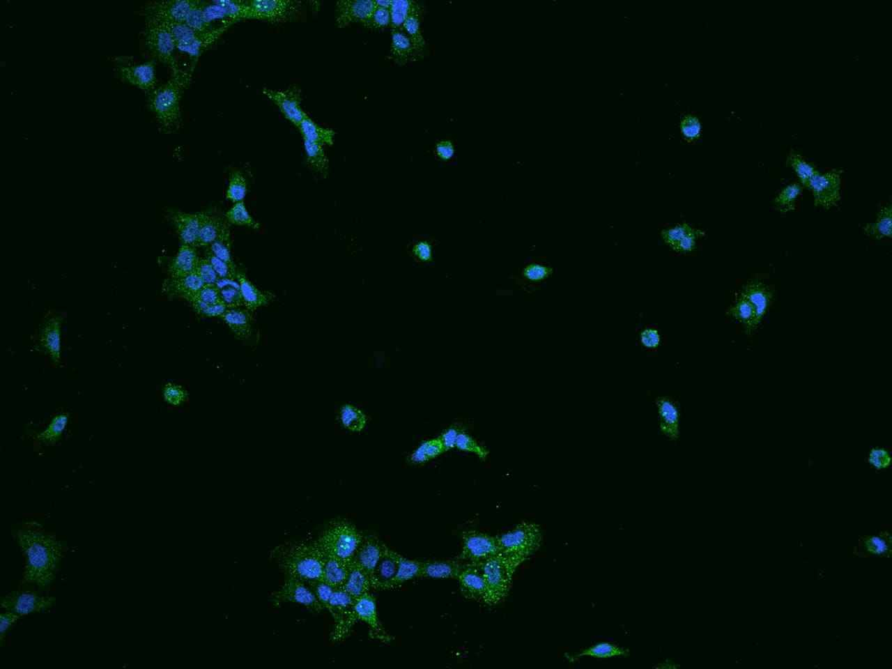Immunocytochemistry/ Immunofluorescence SPAG16 Antibody - BSA Free