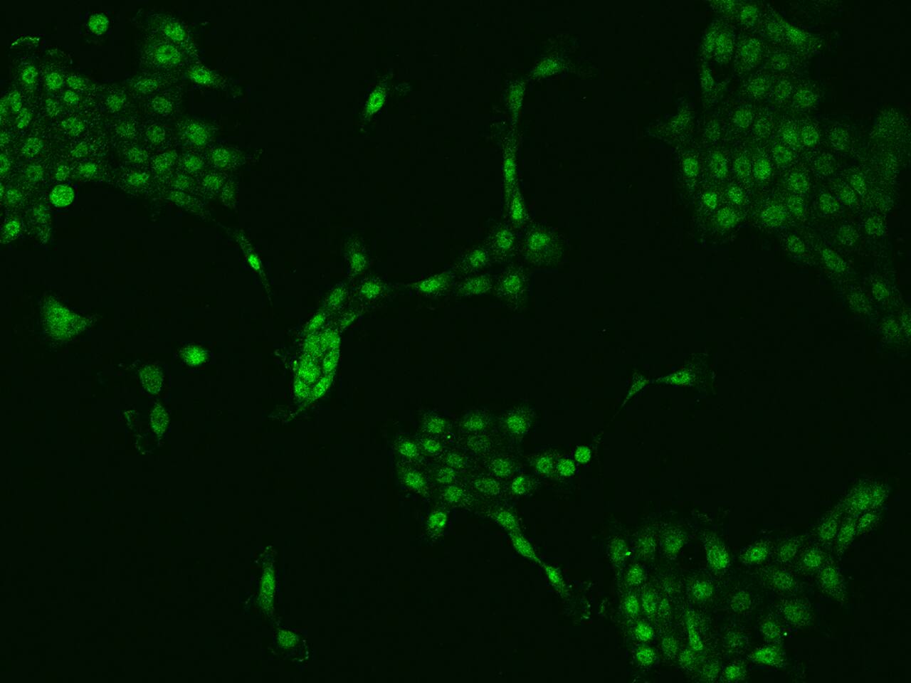 Immunocytochemistry/Immunofluorescence: ZNF251 Antibody [NBP2-97872] - Immunofluorescence staining of ZNF251 in A431 cells. Cells were fixed with 4% PFA, permeabilzed with 0.1% Triton X-100 in PBS, blocked with 10% serum, and incubated with NBP2-97872 antibody (dilution ratio 1:100) at 4C overnight. Then cells were stained with the Alexa Fluor(R)488-conjugated Goat Anti-rabbit IgG secondary antibody (green). Positive staining was localized to Nucleus and Cytoplasm.