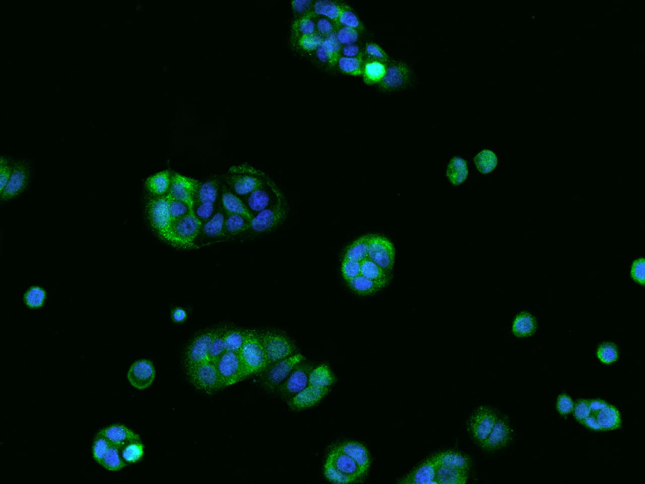 Immunocytochemistry/ Immunofluorescence TPPP2 Antibody - BSA Free