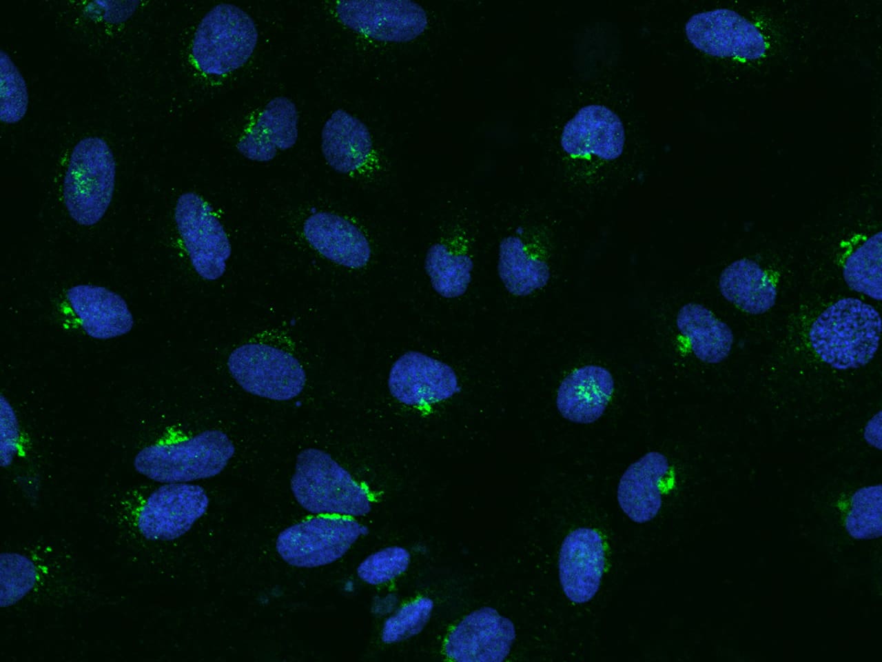 Immunocytochemistry/Immunofluorescence: BSDC1 Antibody [NBP2-97918] - Immunofluorescence staining of BSDC1 in U2OS cells. Cells were fixed with 4% PFA, permeabilzed with 0.1% Triton X-100 in PBS, blocked with 10% serum, and incubated with NBP2-97918 antibody (dilution ratio 1:100) at 4C overnight. Then cells were stained with the Alexa Fluor(R)488-conjugated Goat Anti-rabbit IgG secondary antibody (green) and counterstained with DAPI (blue).Positive staining was localized to Cytoplasm.