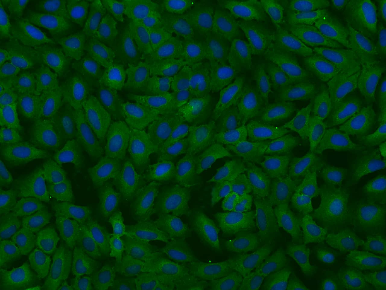 Immunocytochemistry/Immunofluorescence: MTHFD1 Antibody [NBP2-97940] - Immunofluorescence staining of MTHFD1 in U2OS cells. Cells were fixed with 4% PFA, permeabilzed with 0.1% Triton X-100 in PBS, blocked with 10% serum, and incubated with NBP2-97940 antibody (dilution ratio 1:200) at 4C overnight. Then cells were stained with the Alexa Fluor(R)488-conjugated Goat Anti-rabbit IgG secondary antibody (green) and counterstained with DAPI (blue).Positive staining was localized to Cytoplasm.