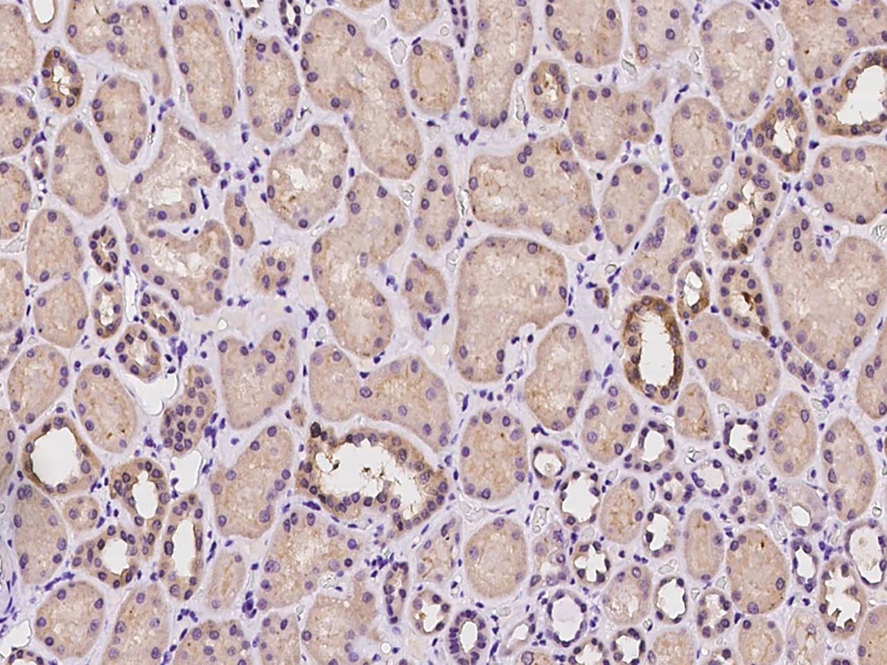 Immunohistochemistry-Paraffin: SUCLG2 Antibody [NBP2-97953] - Immunochemical staining of human SUCLG2 in human kidney with NBP2-97953 at 1:100 dilution, formalin-fixed paraffin embedded sections.