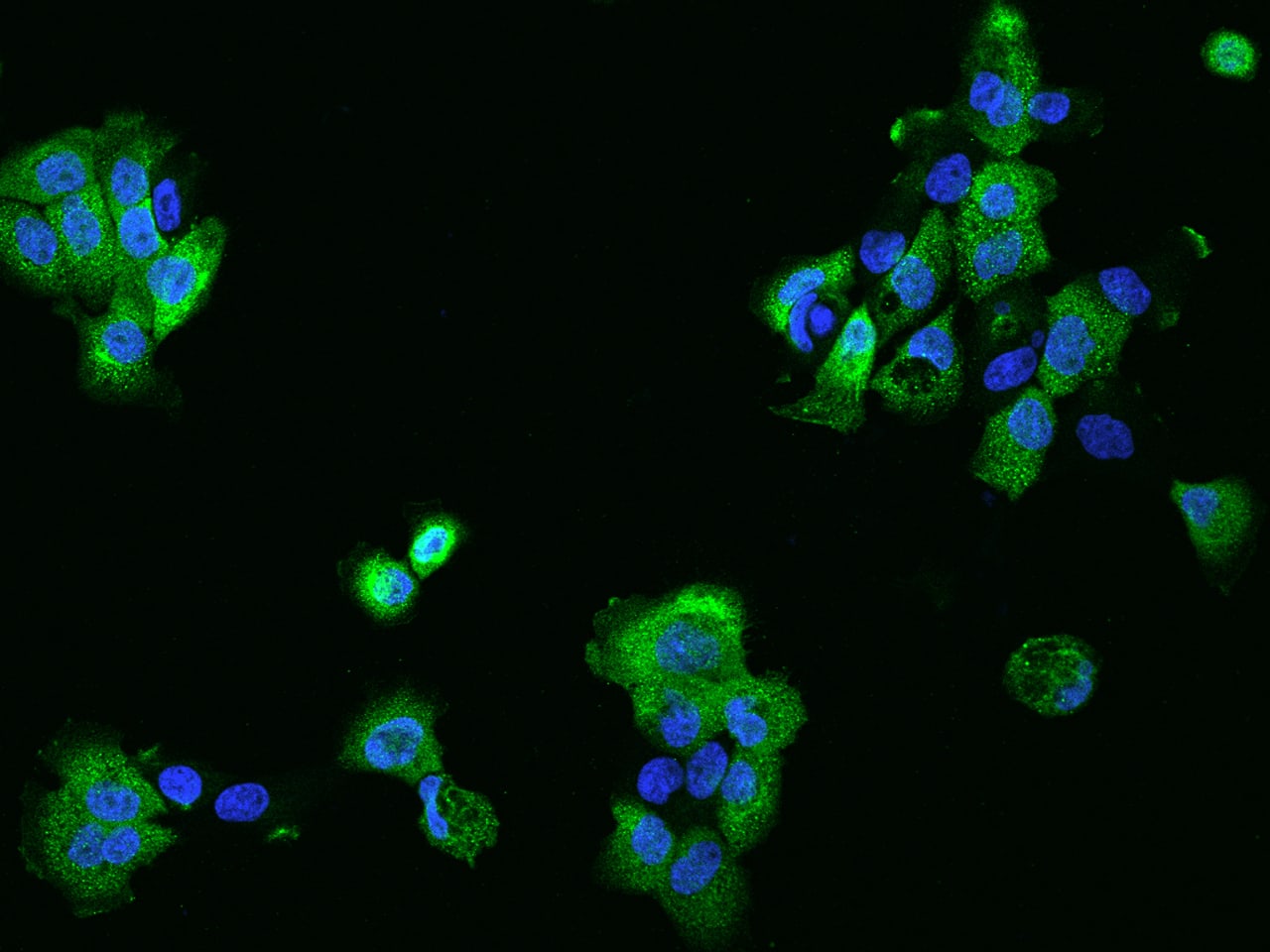 Immunocytochemistry/ Immunofluorescence PHLDB2 Antibody - BSA Free