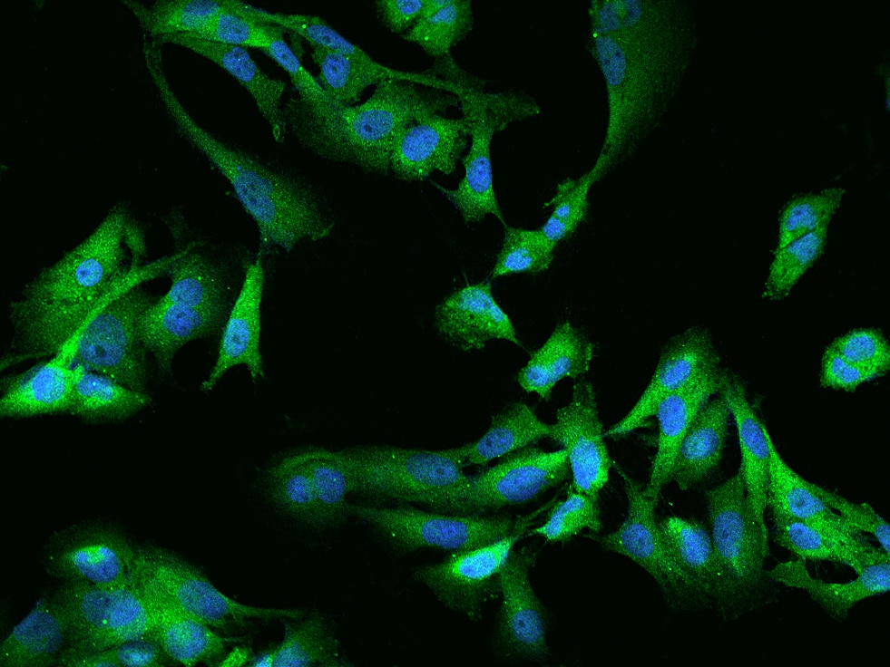 Immunocytochemistry/Immunofluorescence: GSK-3 alpha Antibody [NBP2-97994] - Immunofluorescence staining of GSK-3 alpha in U251MG cells. Cells were fixed with 4% PFA, permeabilzed with 0.1% Triton X-100 in PBS, blocked with 10% serum, and incubated with NBP2-97994 antibody (dilution ratio 1:200) at 4C overnight. Then cells were stained with the Alexa Fluor(R)488-conjugated Goat Anti-rabbit IgG secondary antibody (green) and counterstained with DAPI (blue).Positive staining was localized to Cytoplasm.