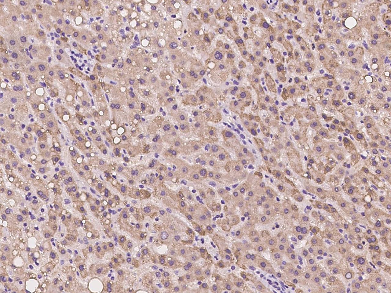 Immunohistochemistry-Paraffin: SPICE1 Antibody - BSA Free [NBP2-97999] - Immunochemical staining of human SPICE1 in human liver with NBP2-97999 at 1:100 dilution, formalin-fixed paraffin embedded sections.