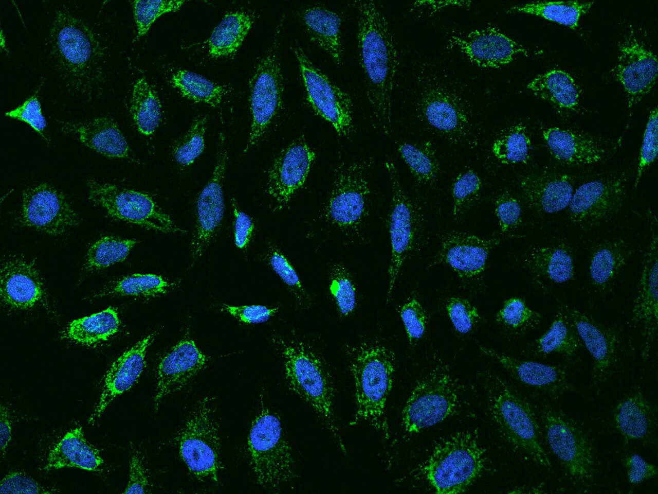 Immunocytochemistry/Immunofluorescence: Ankyrin Repeat Domain 33B Antibody [NBP2-98013] - Immunofluorescence staining of Ankyrin Repeat Domain 33B in HeLa cells. Cells were fixed with 4% PFA, permeabilzed with 0.1% Triton X-100 in PBS, blocked with 10% serum, and incubated with NBP2-98013 antibody (dilution ratio 1:200) at 4C overnight. Then cells were stained with the Alexa Fluor(R)488-conjugated Goat Anti-rabbit IgG secondary antibody (green) and counterstained with DAPI (blue).Positive staining was localized to Cytoplasm.