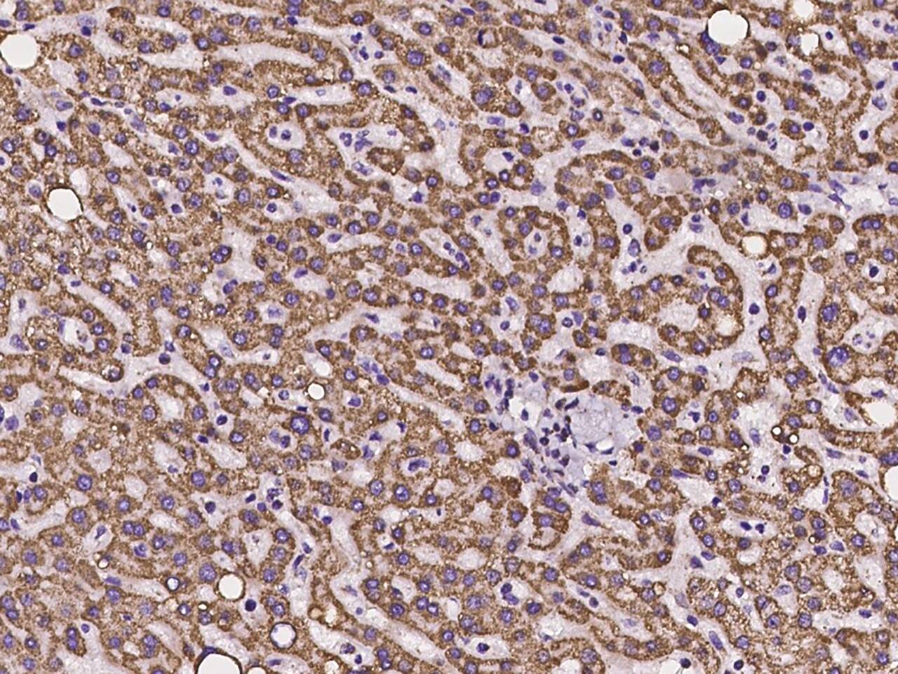 Immunohistochemistry-Paraffin: Ankyrin Repeat Domain 33B Antibody - BSA Free [NBP2-98013] - Immunochemical staining of human Ankyrin Repeat Domain 33B in human liver with NBP2-98013 at 1:100 dilution, formalin-fixed paraffin embedded sections.