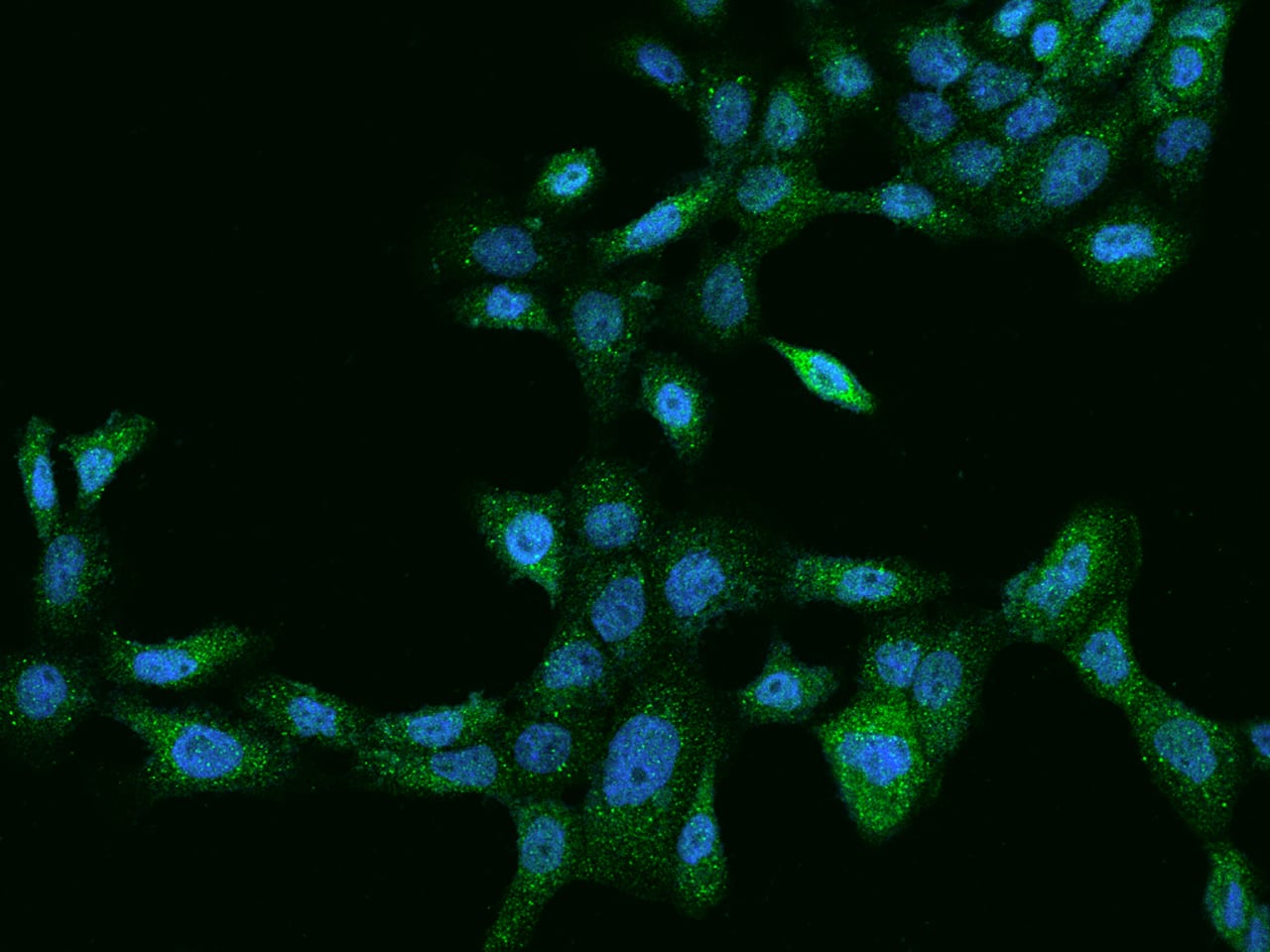 Immunocytochemistry/Immunofluorescence: LYPD6 Antibody [NBP2-98014] - Immunofluorescence staining of LYPD6 in A431 cells. Cells were fixed with 4% PFA, permeabilzed with 0.1% Triton X-100 in PBS, blocked with 10% serum, and incubated with NBP2-98014 antibody (dilution ratio 1:100) at 4C overnight. Then cells were stained with the Alexa Fluor(R)488-conjugated Goat Anti-rabbit IgG secondary antibody (green) and counterstained with DAPI (blue).Positive staining was localized to Cytoplasm.
