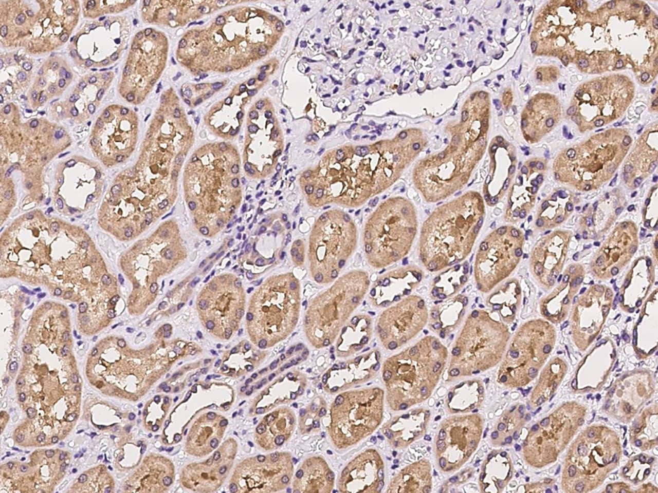 Immunohistochemistry-Paraffin C6orf47 Antibody - BSA Free