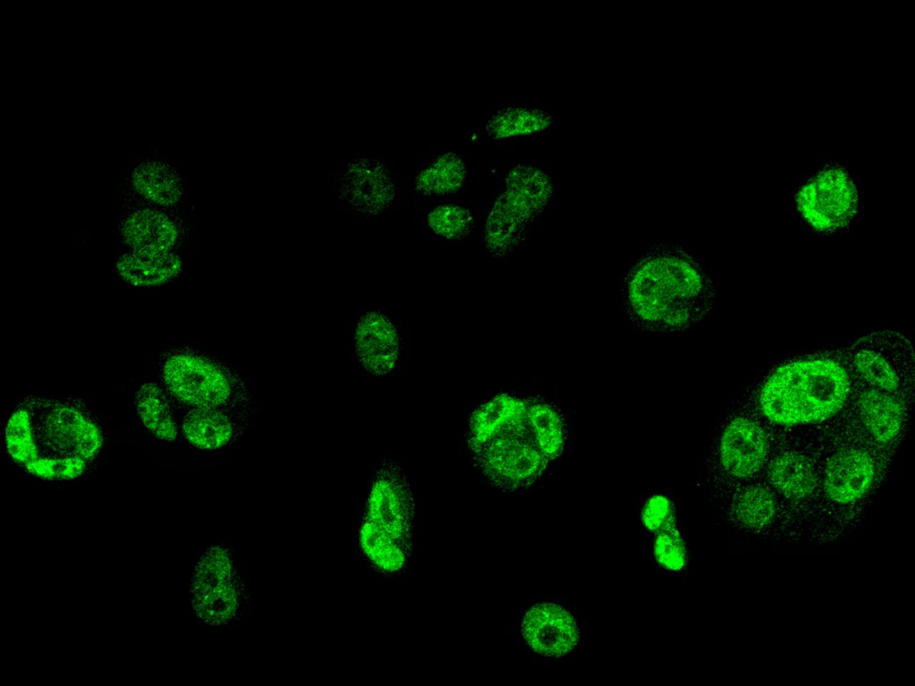 Immunocytochemistry/ Immunofluorescence MORN2 Antibody - BSA Free