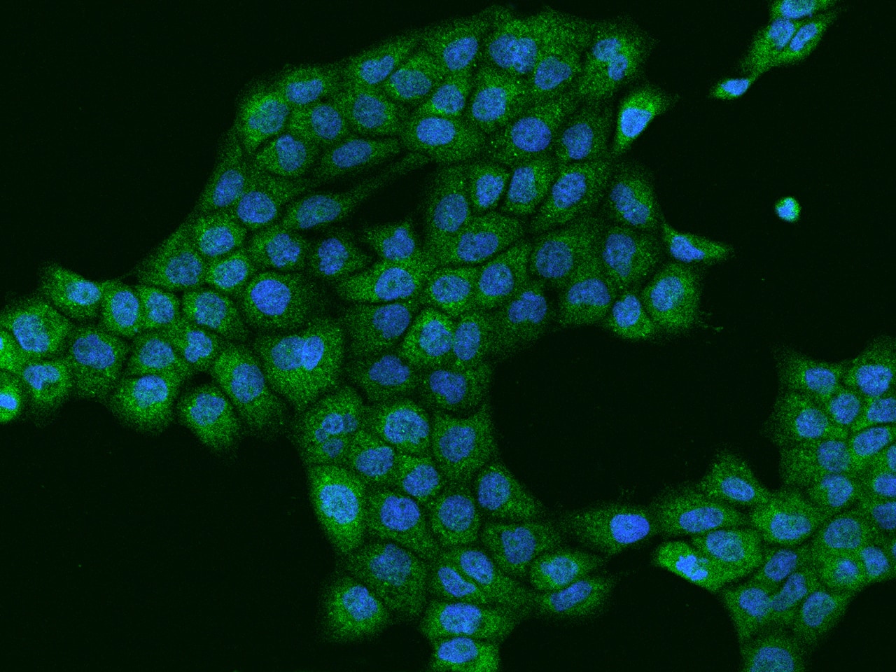Immunocytochemistry/Immunofluorescence: MYO9B Antibody [NBP2-98029] - Immunofluorescence staining of MYO9B in A431 cells. Cells were fixed with 4% PFA, permeabilzed with 0.1% Triton X-100 in PBS, blocked with 10% serum, and incubated with NBP2-98029 antibody (dilution ratio 1:200) at 4C overnight. Then cells were stained with the Alexa Fluor(R)488-conjugated Goat Anti-rabbit IgG secondary antibody (green) and counterstained with DAPI (blue).Positive staining was localized to Cytoplasm.
