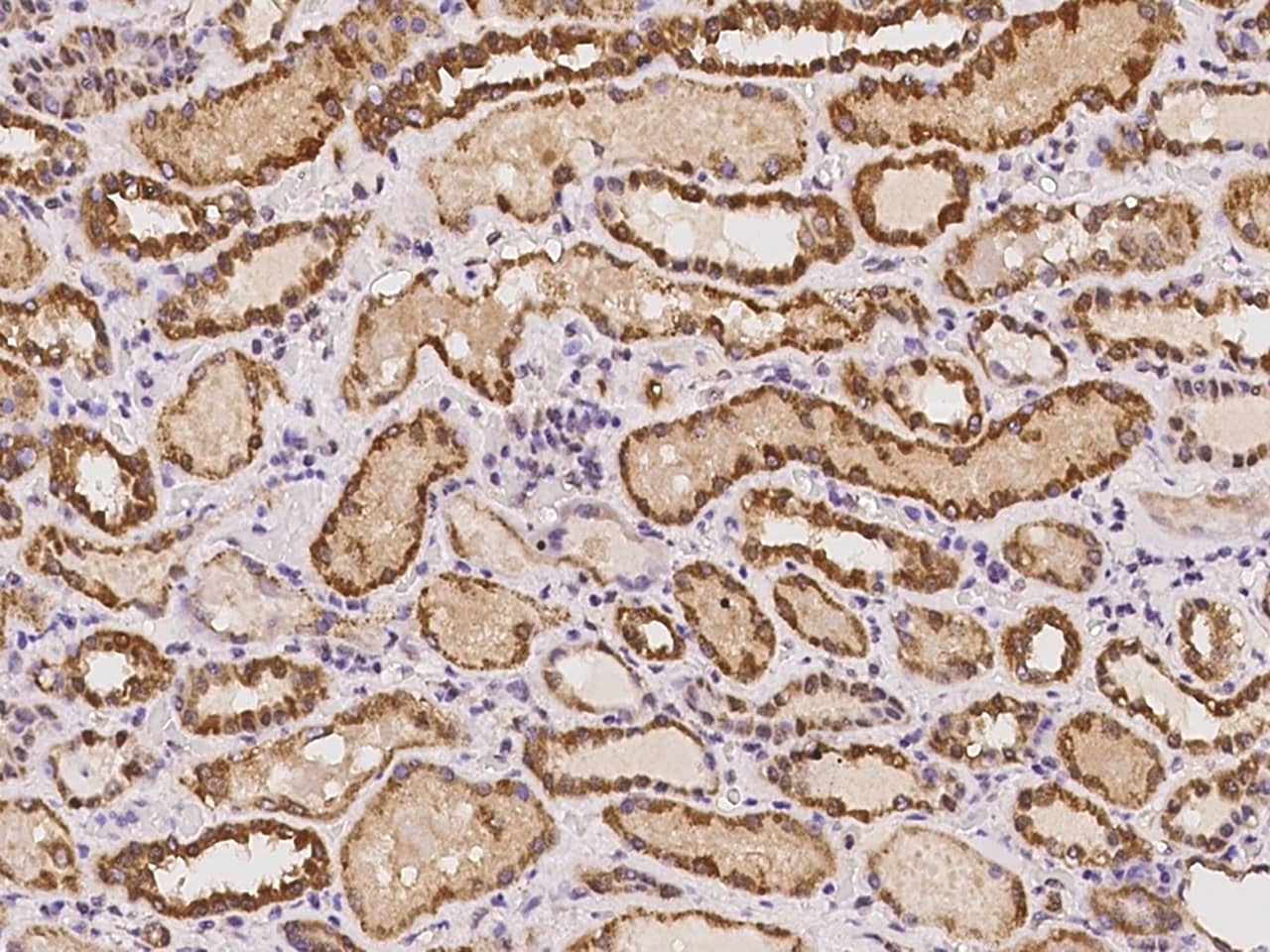 Immunohistochemistry-Paraffin: C20orf96 Antibody - BSA Free [NBP2-98041] - Immunochemical staining of human C20orf96 in human kidney with NBP2-98041 at 1:100 dilution, formalin-fixed paraffin embedded sections.