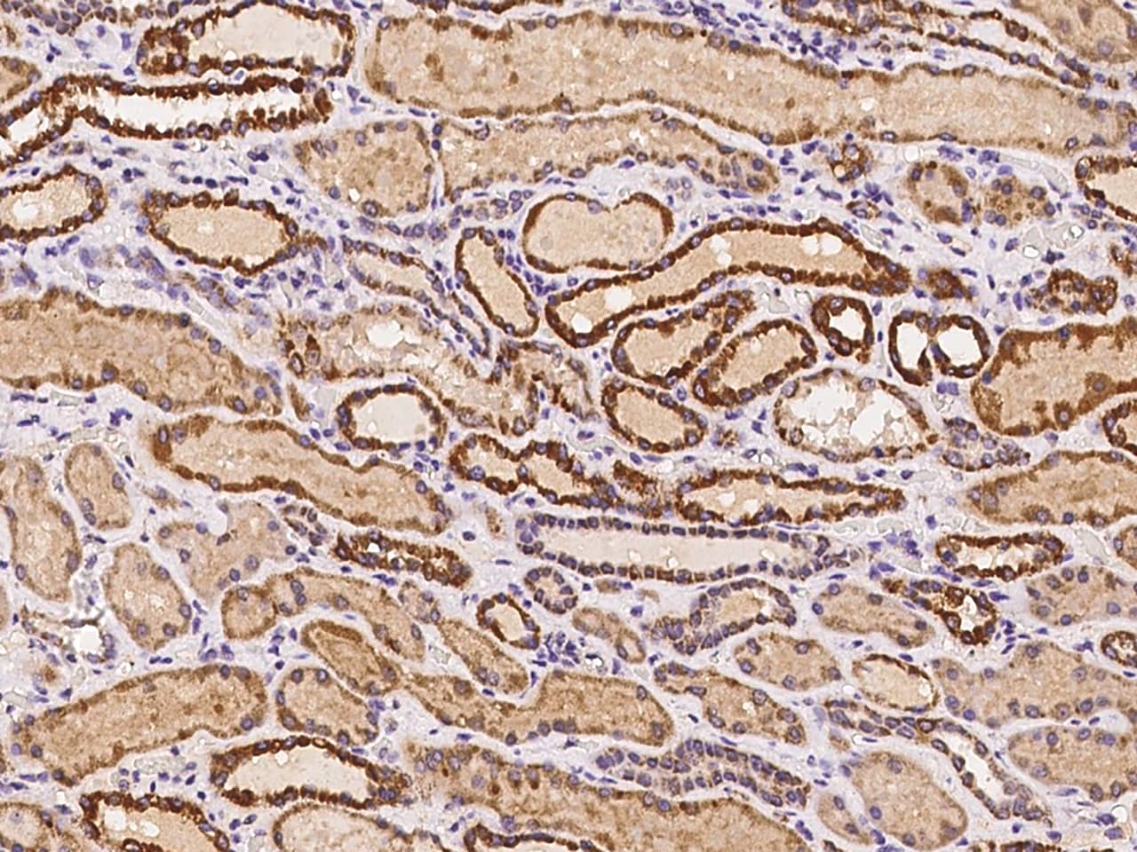 Immunohistochemistry-Paraffin: IBA57 Antibody - BSA Free [NBP2-98047] - Immunochemical staining of human IBA57 in human kidney with NBP2-98047 at 1:100 dilution, formalin-fixed paraffin embedded sections.