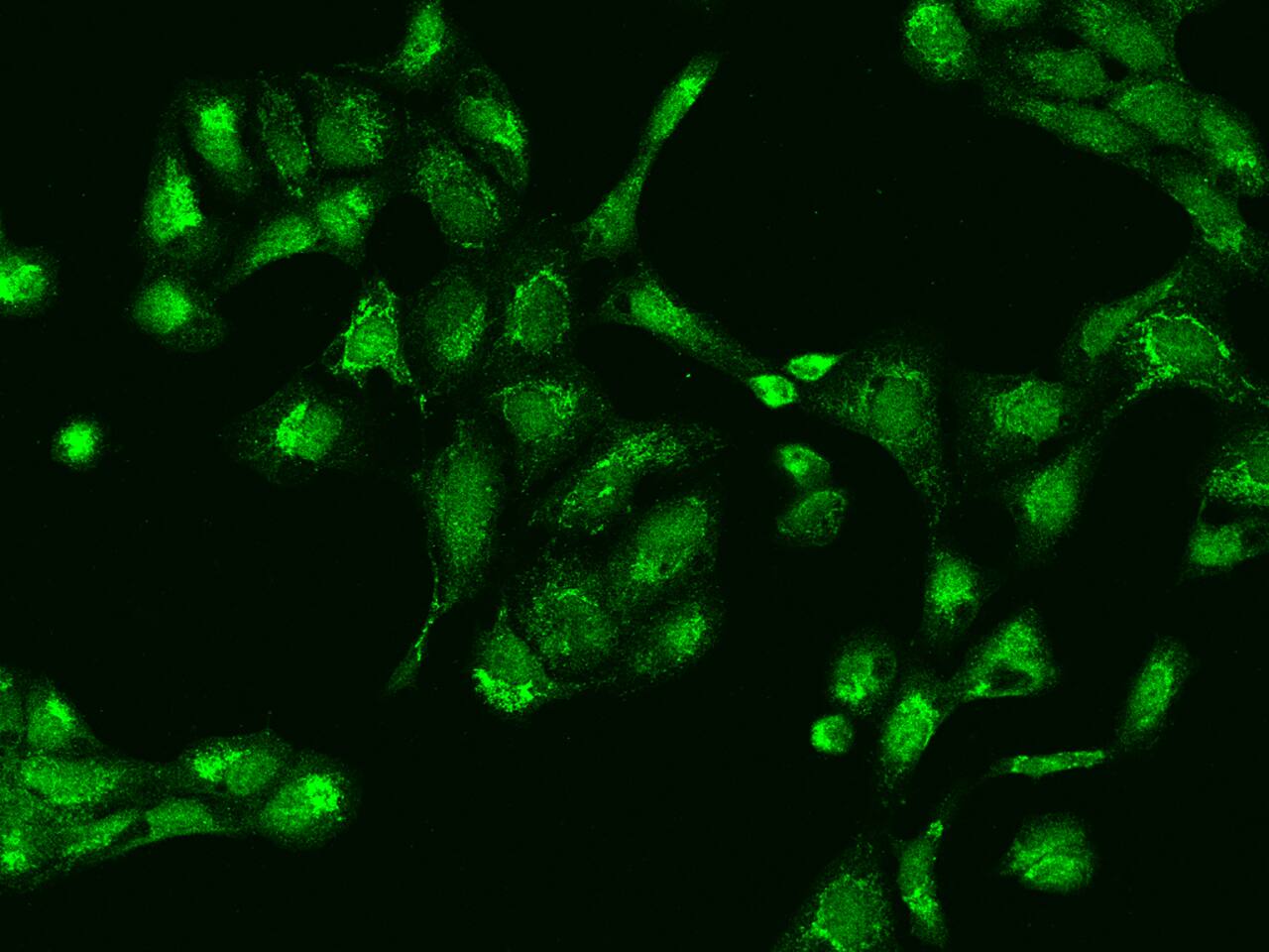 Immunocytochemistry/Immunofluorescence: RG9MTD1 Antibody [NBP2-98053] - Immunofluorescence staining of RG9MTD1 in U2OS cells. Cells were fixed with 4% PFA, permeabilzed with 0.1% Triton X-100 in PBS, blocked with 10% serum, and incubated with NBP2-98053 antibody (dilution ratio 1:200) at 4C overnight. Then cells were stained with the Alexa Fluor(R)488-conjugated Goat Anti-rabbit IgG Secondary antibody (green). Positive staining was localized to Nucleus and Cytoplasm.