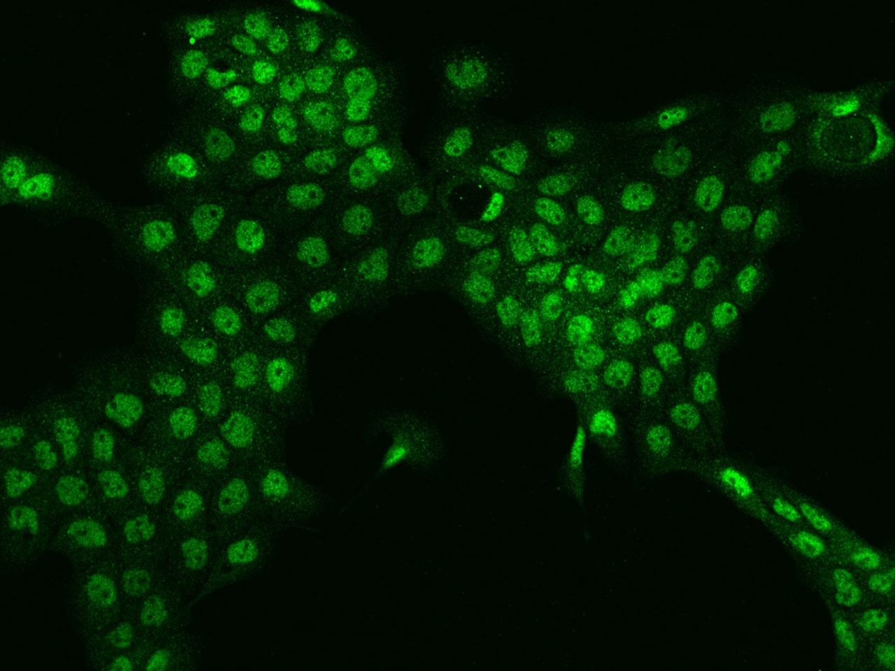 Immunocytochemistry/Immunofluorescence: TESK2 Antibody [NBP2-98073] - Immunofluorescence staining of TESK2 in A431 cells. Cells were fixed with 4% PFA, permeabilzed with 0.1% Triton X-100 in PBS, blocked with 10% serum, and incubated with NBP2-98073 antibody (dilution ratio 1:100) at 4C overnight. Then cells were stained with the Alexa Fluor(R)488-conjugated Goat Anti-rabbit IgG secondary antibody (green). Positive staining was localized to Nucleus.