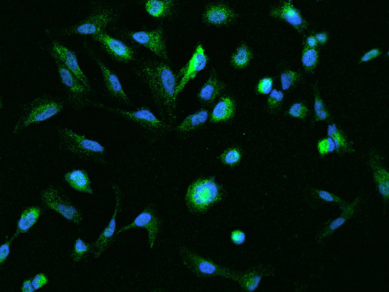Immunocytochemistry/Immunofluorescence: RUBCNL Antibody [NBP2-98088] - Immunofluorescence staining of RUBCNL in U251MG cells. Cells were fixed with 4% PFA, permeabilzed with 0.1% Triton X-100 in PBS, blocked with 10% serum, and incubated with NBP2-98088 antibody (dilution ratio 1:200) at 4C overnight. Then cells were stained with the Alexa Fluor(R)488-conjugated Goat Anti-rabbit IgG Secondary antibody (green) and counterstained with DAPI (blue).Positive staining was localized to Cytoplasm.