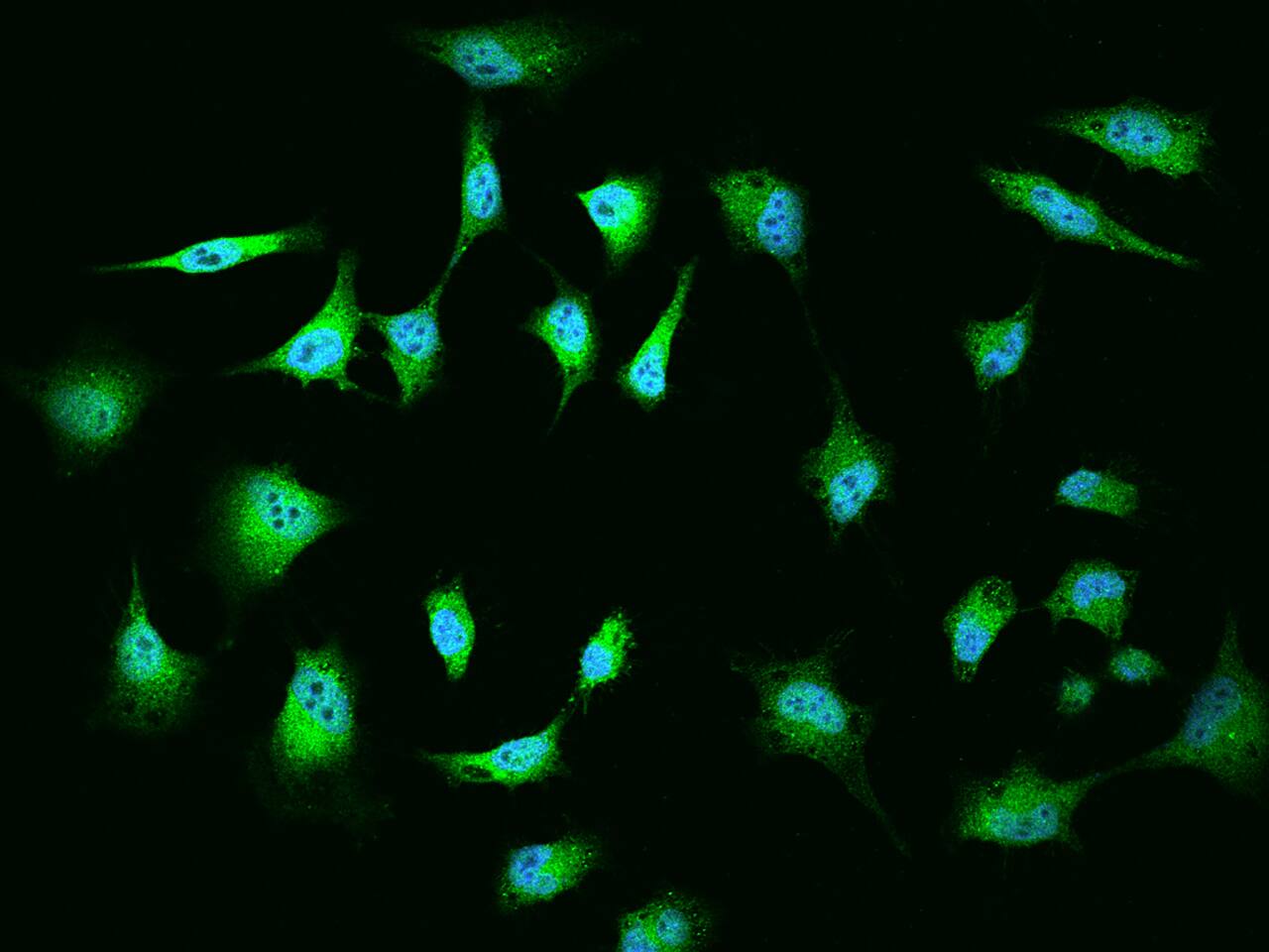 Immunocytochemistry/Immunofluorescence: MGA Antibody [NBP2-98097] - Immunofluorescence staining of MGA in HeLa cells. Cells were fixed with 4% PFA, permeabilzed with 0.1% Triton X-100 in PBS, blocked with 10% serum, and incubated with NBP2-98097 antibody (dilution ratio 1:200) at 4C overnight. Then cells were stained with the Alexa Fluor(R)488-conjugated Goat Anti-rabbit IgG secondary antibody (green) and counterstained with DAPI (blue).Positive staining was localized to Nucleus and Cytoplasm.