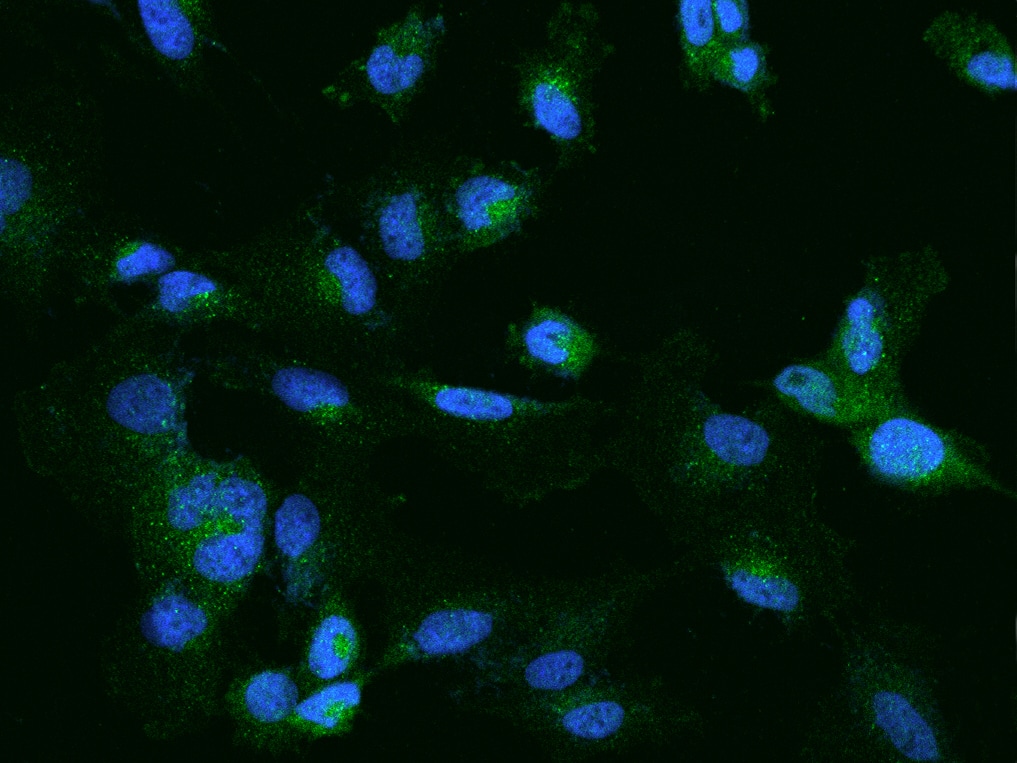 Immunocytochemistry/Immunofluorescence: CELSR2 Antibody [NBP2-98104] - Immunofluorescence staining of CELSR2 in U251MG cells. Cells were fixed with 4% PFA, permeabilzed with 0.1% Triton X-100 in PBS, blocked with 10% serum, and incubated with NBP2-98104 antibody (dilution ratio 1:200) at 4C overnight. Then cells were stained with the Alexa Fluor(R)488-conjugated Goat Anti-rabbit IgG secondary antibody (green) and counterstained with DAPI (blue).Positive staining was localized to Cytoplasm.