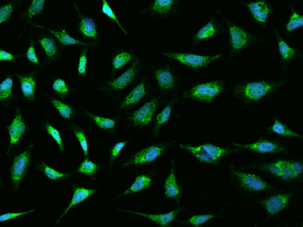 Immunocytochemistry/Immunofluorescence: SLC3A1 Antibody [NBP2-98113] - Immunofluorescence staining of SLC3A1 in HeLa cells. Cells were fixed with 4% PFA, permeabilzed with 0.1% Triton X-100 in PBS, blocked with 10% serum, and incubated with NBP2-98113 antibody (dilution ratio 1:200) at 4C overnight. Then cells were stained with the Alexa Fluor(R)488-conjugated Goat Anti-rabbit IgG secondary antibody (green) and counterstained with DAPI (blue).Positive staining was localized to Cytoplasm.