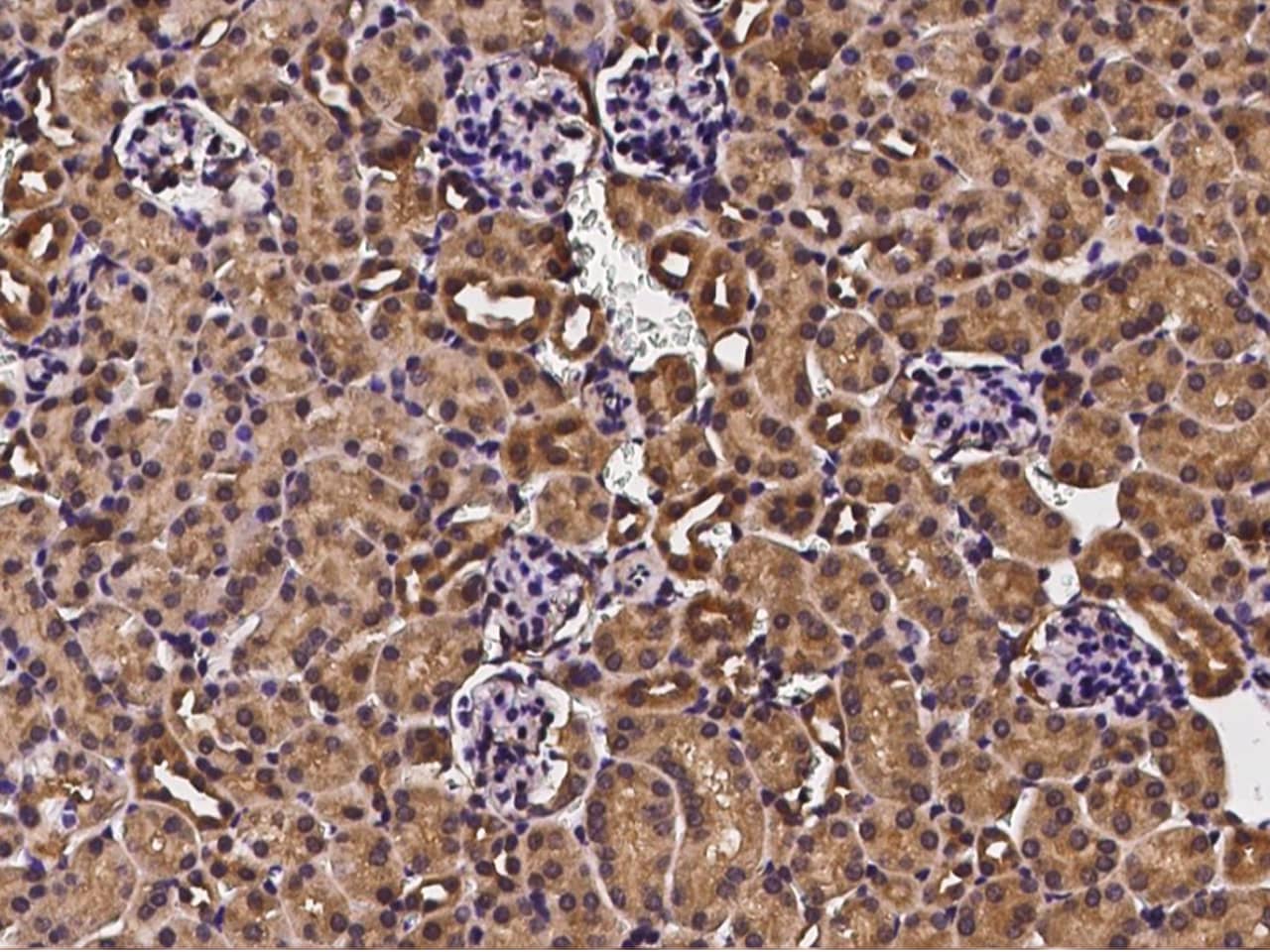 Immunohistochemistry-Paraffin CDC37 Antibody - Azide and BSA Free