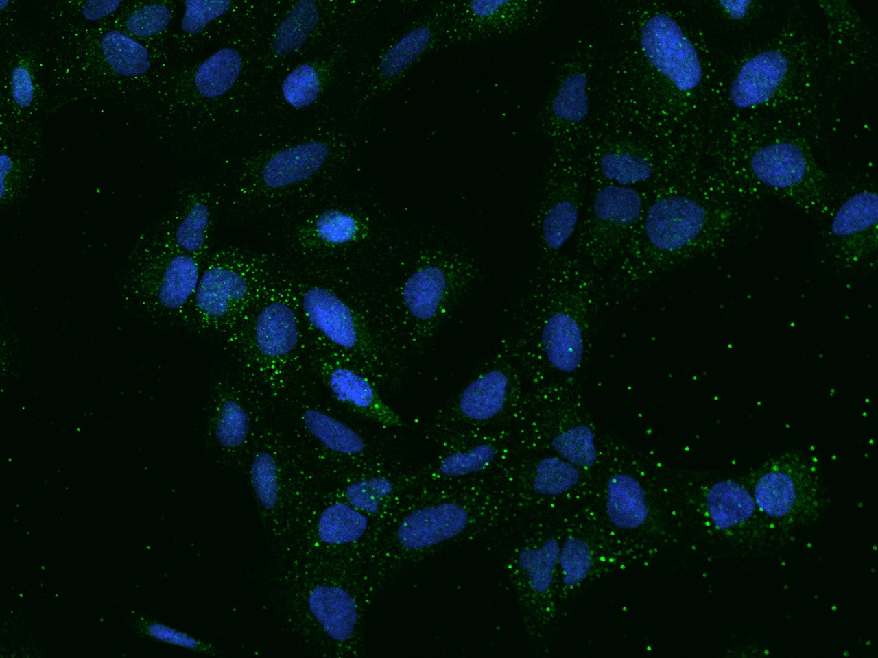 Immunocytochemistry/Immunofluorescence: SMIM5 Antibody [NBP2-98123] - Immunofluorescence staining of SMIM5 in U2OS cells. Cells were fixed with 4% PFA, permeabilzed with 0.1% Triton X-100 in PBS, blocked with 10% serum, and incubated with NBP2-98123 antibody (dilution ratio 1:100) at 4C overnight. Then cells were stained with the Alexa Fluor(R)488-conjugated Goat Anti-rabbit IgG secondary antibody (green) and counterstained with DAPI (blue).Positive staining was localized to Cytoplasm.