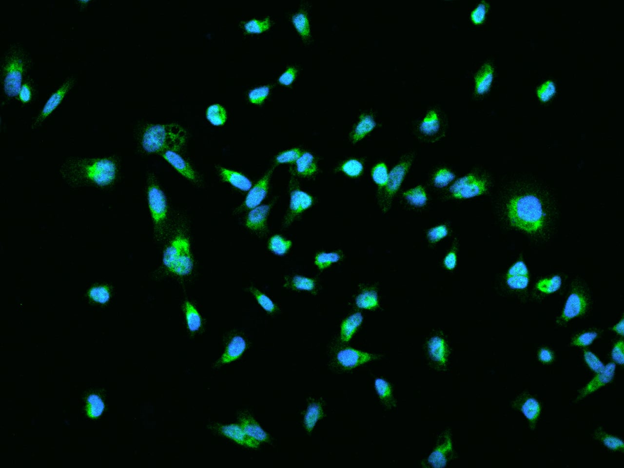 Immunocytochemistry/Immunofluorescence: HSPC132 Antibody [NBP2-98141] - Immunofluorescence staining of HSPC132 in PC3 cells. Cells were fixed with 4% PFA, permeabilzed with 0.1% Triton X-100 in PBS, blocked with 10% serum, and incubated with NBP2-98141 antibody (dilution ratio 1:200) at 4C overnight. Then cells were stained with the Alexa Fluor(R)488-conjugated Goat Anti-rabbit IgG secondary antibody (green) and counterstained with DAPI (blue).Positive staining was localized to Nucleus and Cytoplasm.