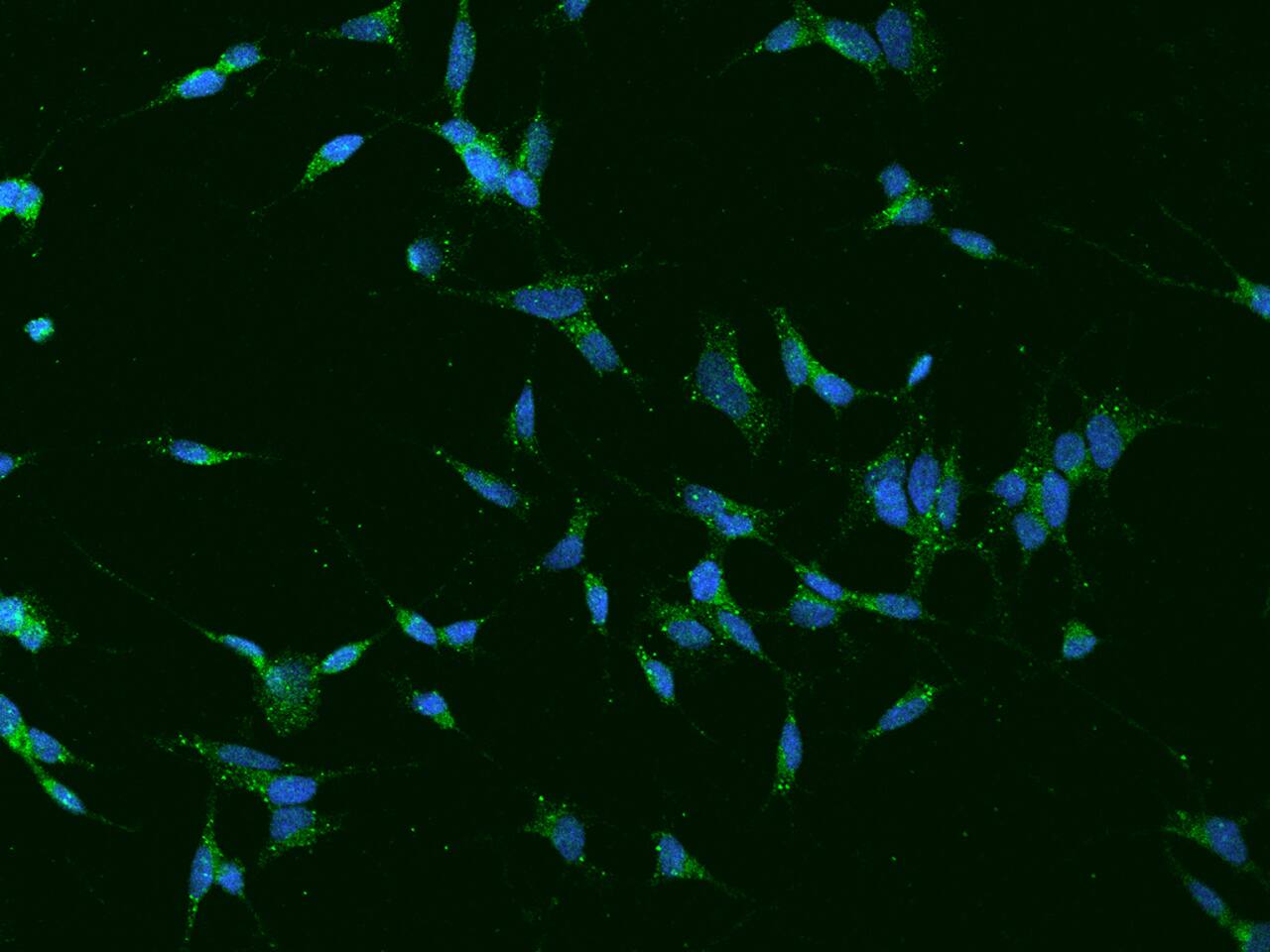 Immunocytochemistry/Immunofluorescence: TVP23A Antibody [NBP2-98146] - Immunofluorescence staining of TVP23A in SHSY5Y cells. Cells were fixed with 4% PFA, permeabilzed with 0.1% Triton X-100 in PBS, blocked with 10% serum, and incubated with NBP2-98146 antibody (dilution ratio 1:100) at 4C overnight. Then cells were stained with the Alexa Fluor(R)488-conjugated Goat Anti-rabbit IgG secondary antibody (green) and counterstained with DAPI (blue).Positive staining was localized to Cytoplasm.
