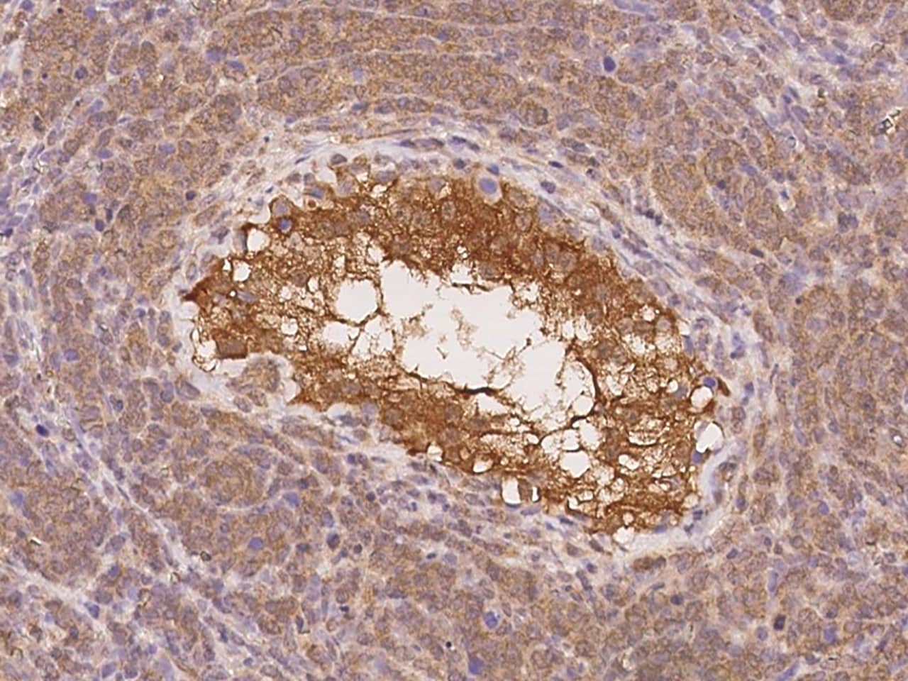 Immunohistochemistry-Paraffin: SOWAHD Antibody [NBP2-98173] - Immunochemical staining of human SOWAHD in human testis with NBP2-98173 at 1:100 dilution, formalin-fixed paraffin embedded sections.