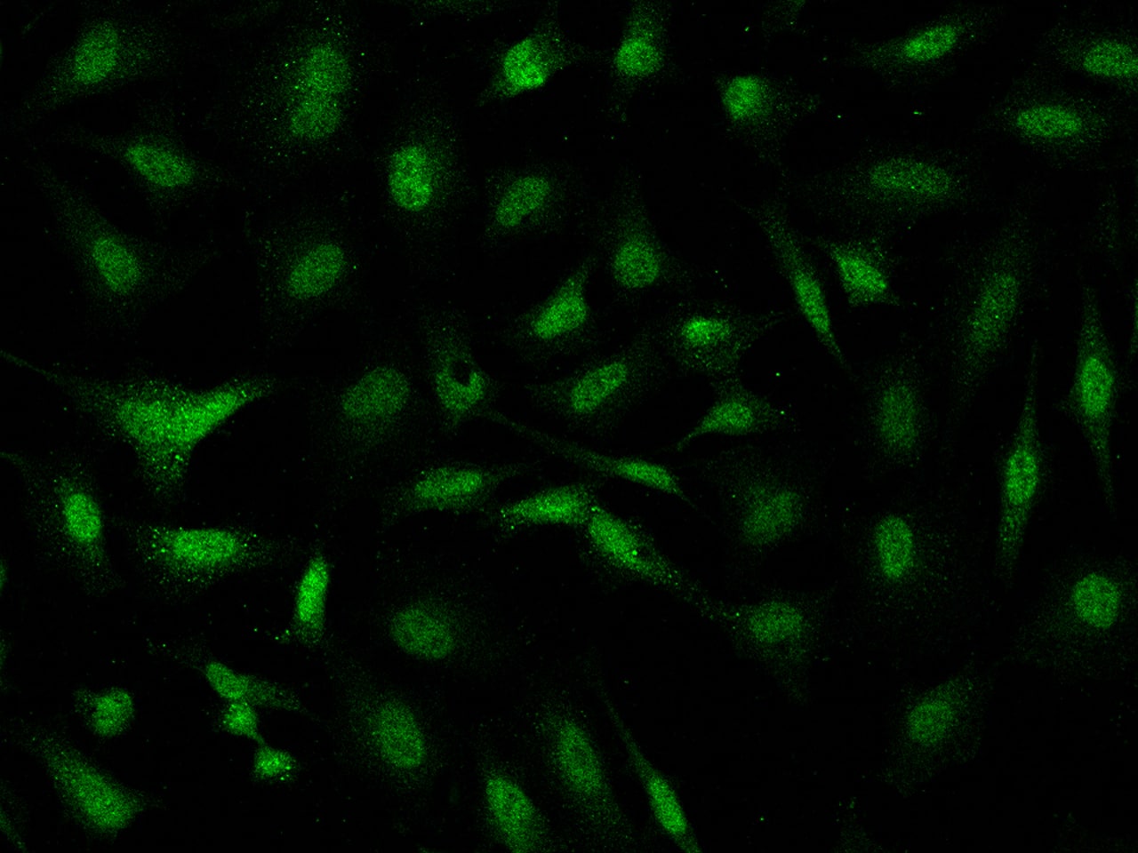 Immunocytochemistry/ Immunofluorescence PGBD4 Antibody - BSA Free