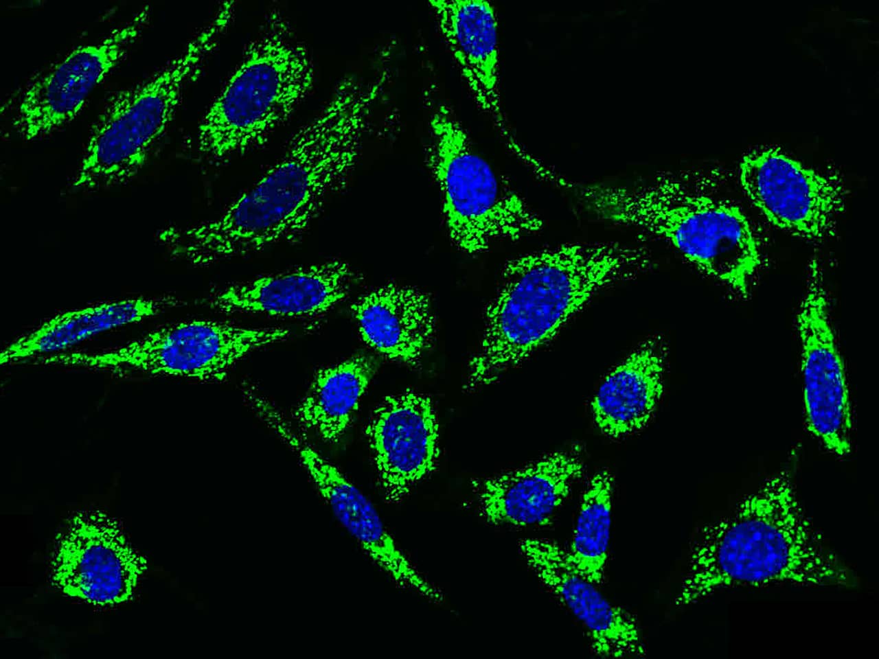 Immunocytochemistry/Immunofluorescence: HABP1/C1QBP/GC1q R Antibody [NBP2-98236] - Immunofluorescence staining of HABP1/C1QBP/GC1q R in NIH-3T3 cells. Cells were fixed with 4% PFA, permeabilzed with 0.1% Triton X-100 in PBS, blocked with 10% serum, and incubated with NBP2-98236 antibody (dilution ratio 1:1000) at 4C overnight. Then cells were stained with the Alexa Fluor$488-conjugated Goat Anti-rabbit IgG Secondary antibody (green) and counterstained with DAPI (blue).Positive staining was localized to cytoplasm.