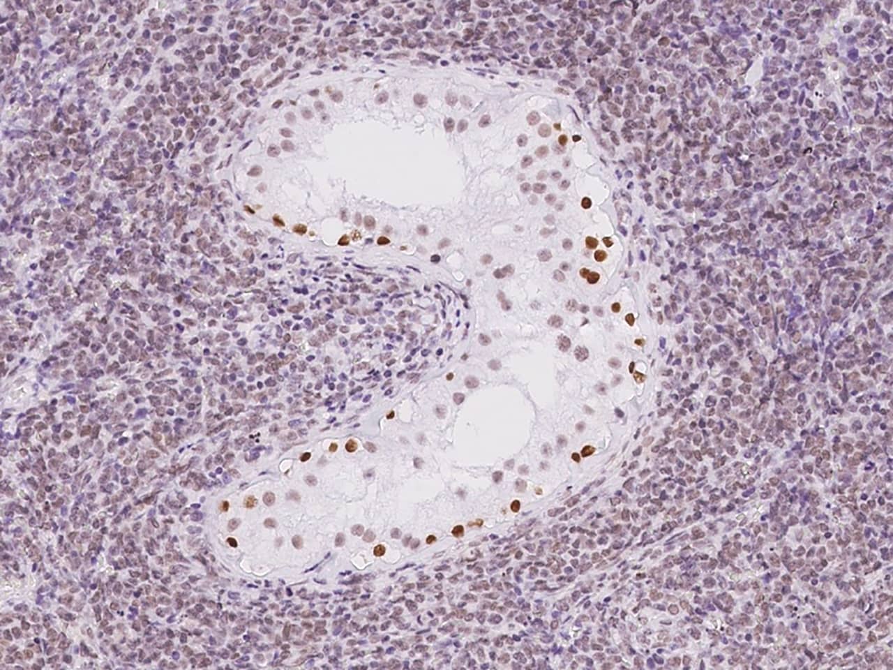 Immunohistochemistry-Paraffin: THYN1 Antibody [NBP2-98501] - Immunochemical staining of human THYN1 in human testis with NBP2-98501 at 1:500 dilution, formalin-fixed paraffin embedded sections.