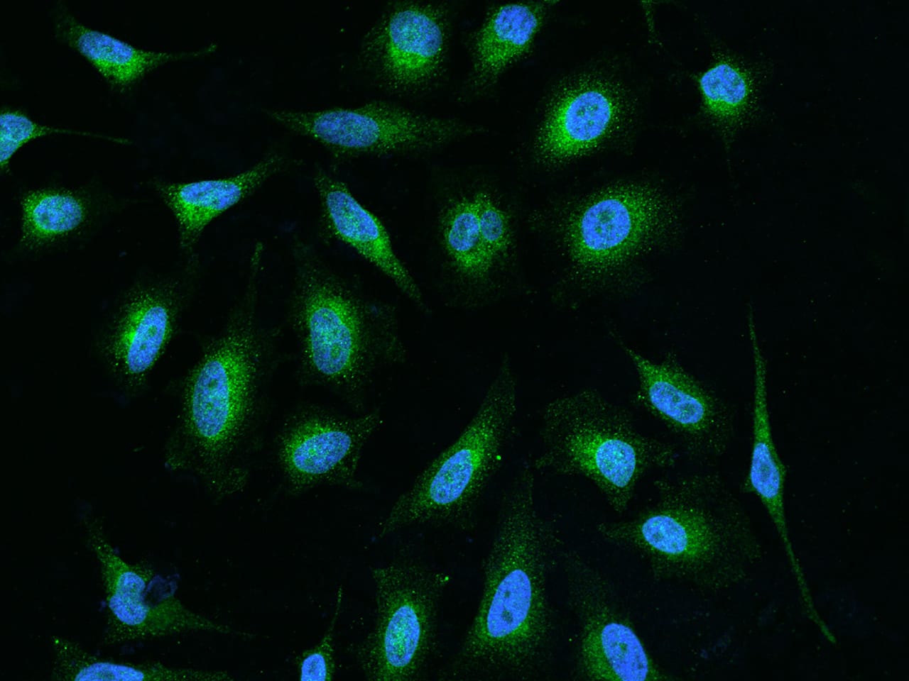 Immunocytochemistry/Immunofluorescence: GGCX Antibody [NBP2-98509] - Immunofluorescence staining of GGCX in HeLa cells. Cells were fixed with 4% PFA, permeabilzed with 0.1% Triton X-100 in PBS, blocked with 10% serum, and incubated with NBP2-98509 antibody (dilution ratio 1:200) at 4C overnight. Then cells were stained with the Alexa Fluor(R)488-conjugated Goat Anti-rabbit IgG secondary antibody (green) and counterstained with DAPI (blue).Positive staining was localized to Cytoplasm.