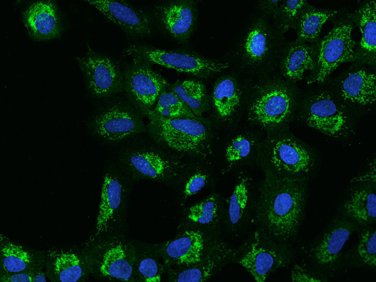 Immunocytochemistry/Immunofluorescence: MRPS5 Antibody [NBP2-98525] - Immunofluorescence staining of MRPS5 in U2OS cells. Cells were fixed with 4% PFA, permeabilzed with 0.1% Triton X-100 in PBS, blocked with 10% serum, and incubated with NBP2-98525 antibody (dilution ratio 1:200) at 4C overnight. Then cells were stained with the Alexa Fluor(R)488-conjugated Goat Anti-rabbit IgG secondary antibody (green) and counterstained with DAPI (blue).Positive staining was localized to Cytoplasm.