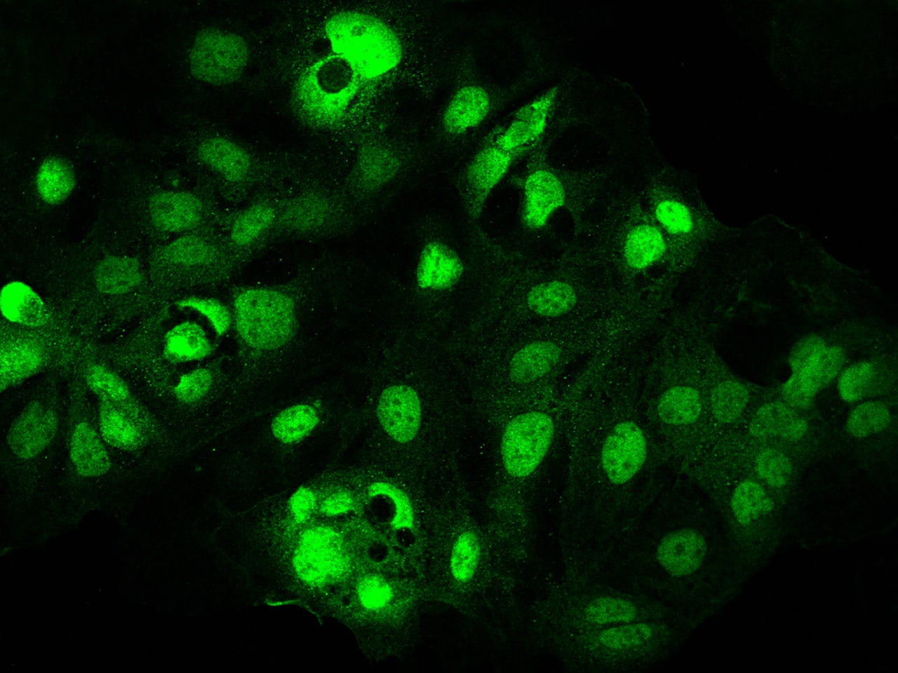 Immunocytochemistry/ Immunofluorescence PEPT1/SLC15A1 Antibody - BSA Free