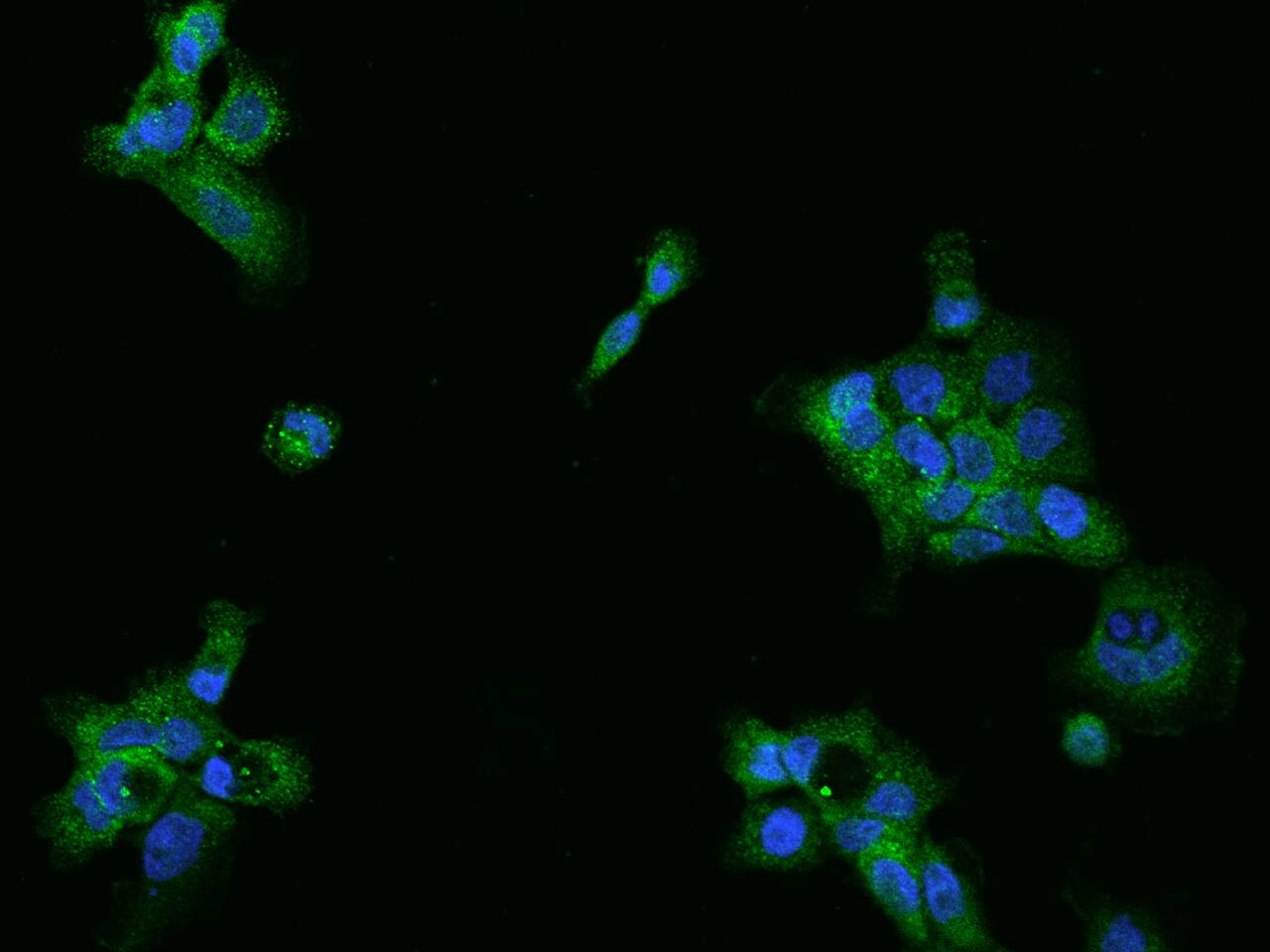 Immunocytochemistry/ Immunofluorescence UBAP1 Antibody - BSA Free