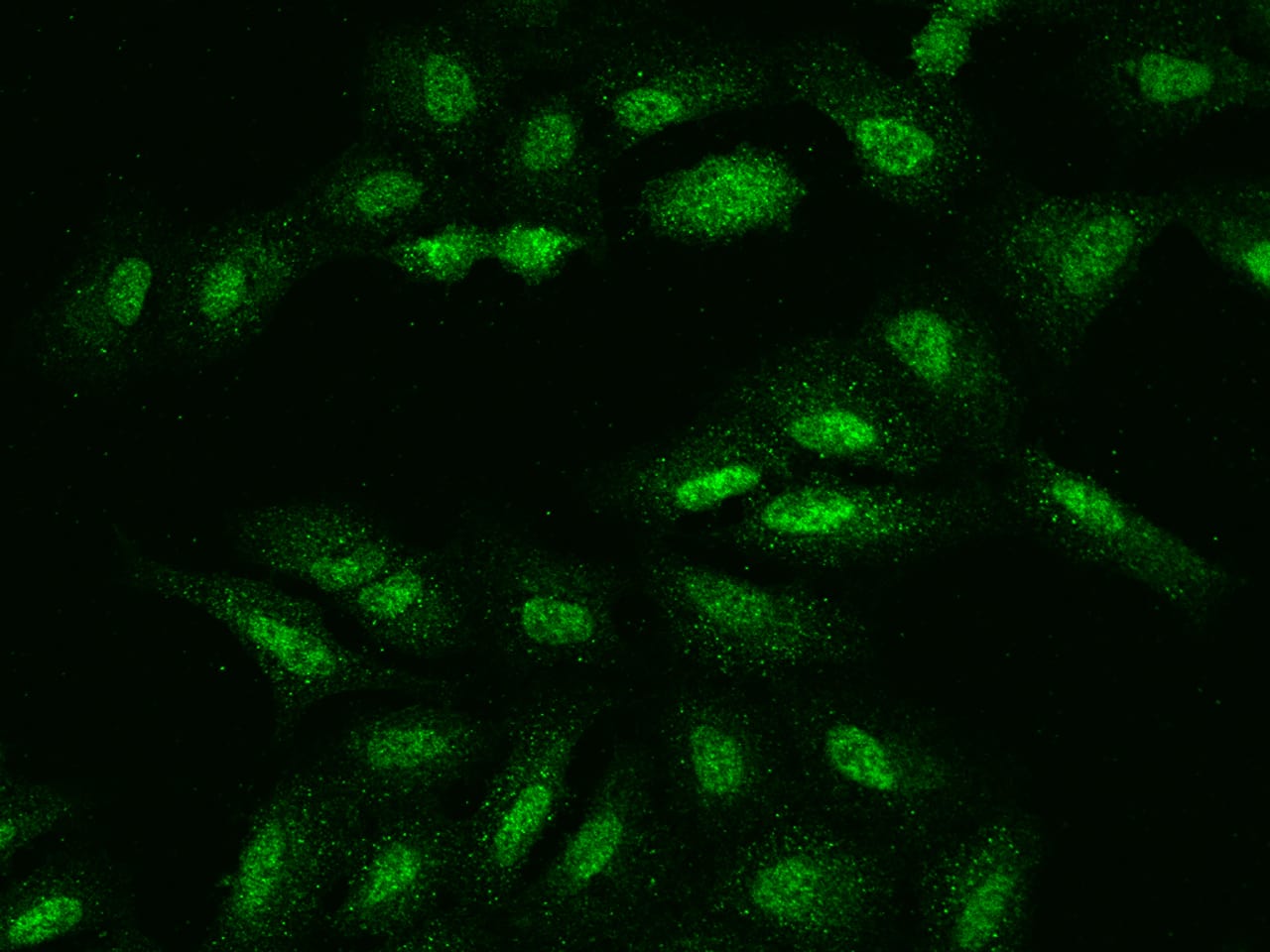 Immunocytochemistry/Immunofluorescence: UCK Antibody [NBP2-98565] - Immunofluorescence staining of UCK in U2OS cells. Cells were fixed with 4% PFA, permeabilzed with 0.1% Triton X-100 in PBS, blocked with 10% serum, and incubated with NBP2-98565 antibody (dilution ratio 1:200) at 4C overnight. Then cells were stained with the Alexa Fluor(R)488-conjugated Goat Anti-rabbit IgG secondary antibody (green). Positive staining was localized to Nucleus.