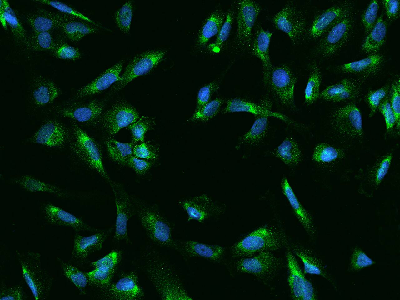 Immunocytochemistry/Immunofluorescence: UCKL1 Antibody [NBP2-98566] - Immunofluorescence staining of UCKL1 in U251MG cells. Cells were fixed with 4% PFA, permeabilzed with 0.1% Triton X-100 in PBS, blocked with 10% serum, and incubated with NBP2-98566 antibody (dilution ratio 1:200) at 4C overnight. Then cells were stained with the Alexa Fluor(R)488-conjugated Goat Anti-rabbit IgG secondary antibody (green) and counterstained with DAPI (blue).Positive staining was localized to Cytoplasm.
