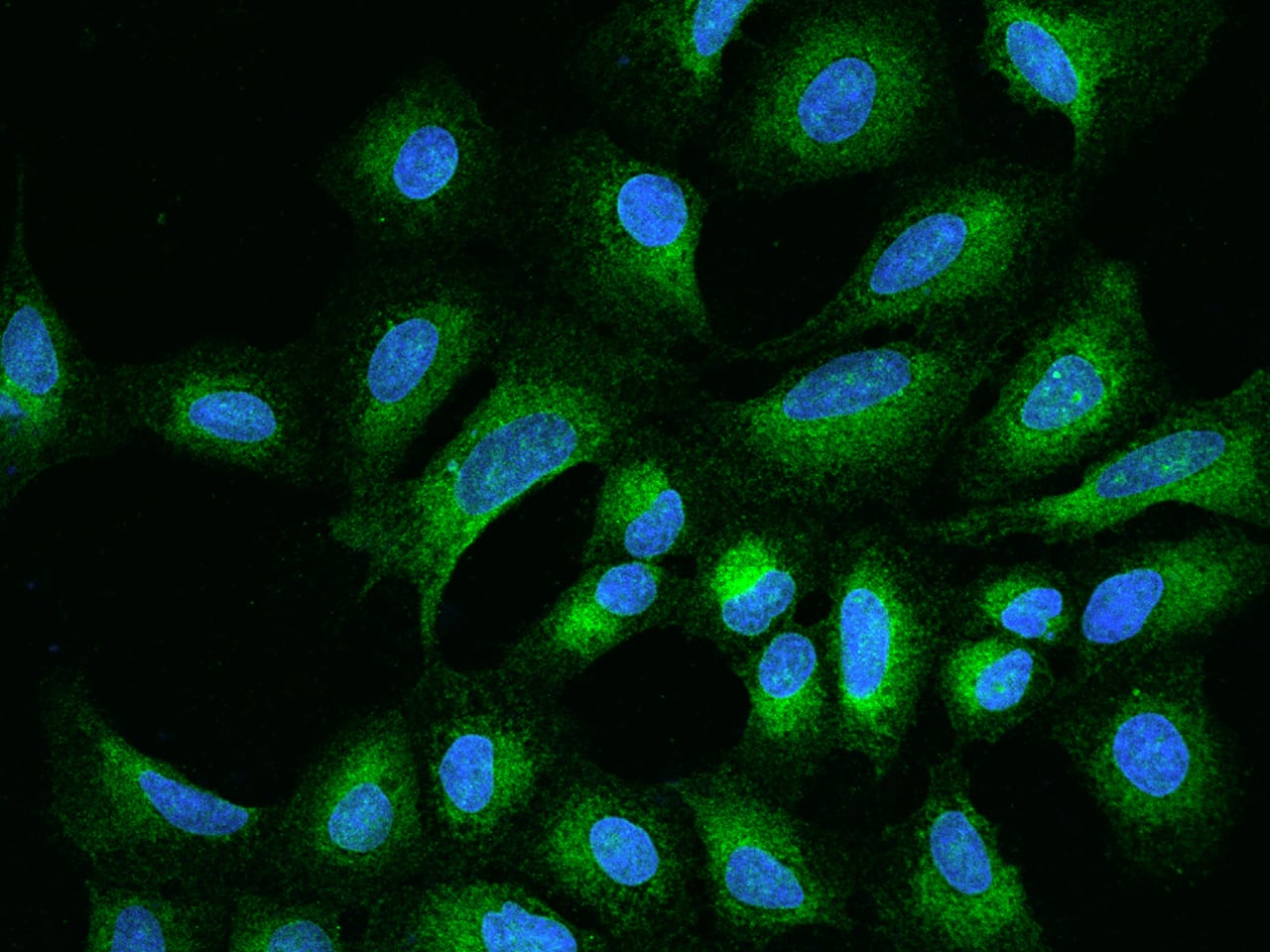 Immunocytochemistry/ Immunofluorescence Derlin-2 Antibody - BSA Free