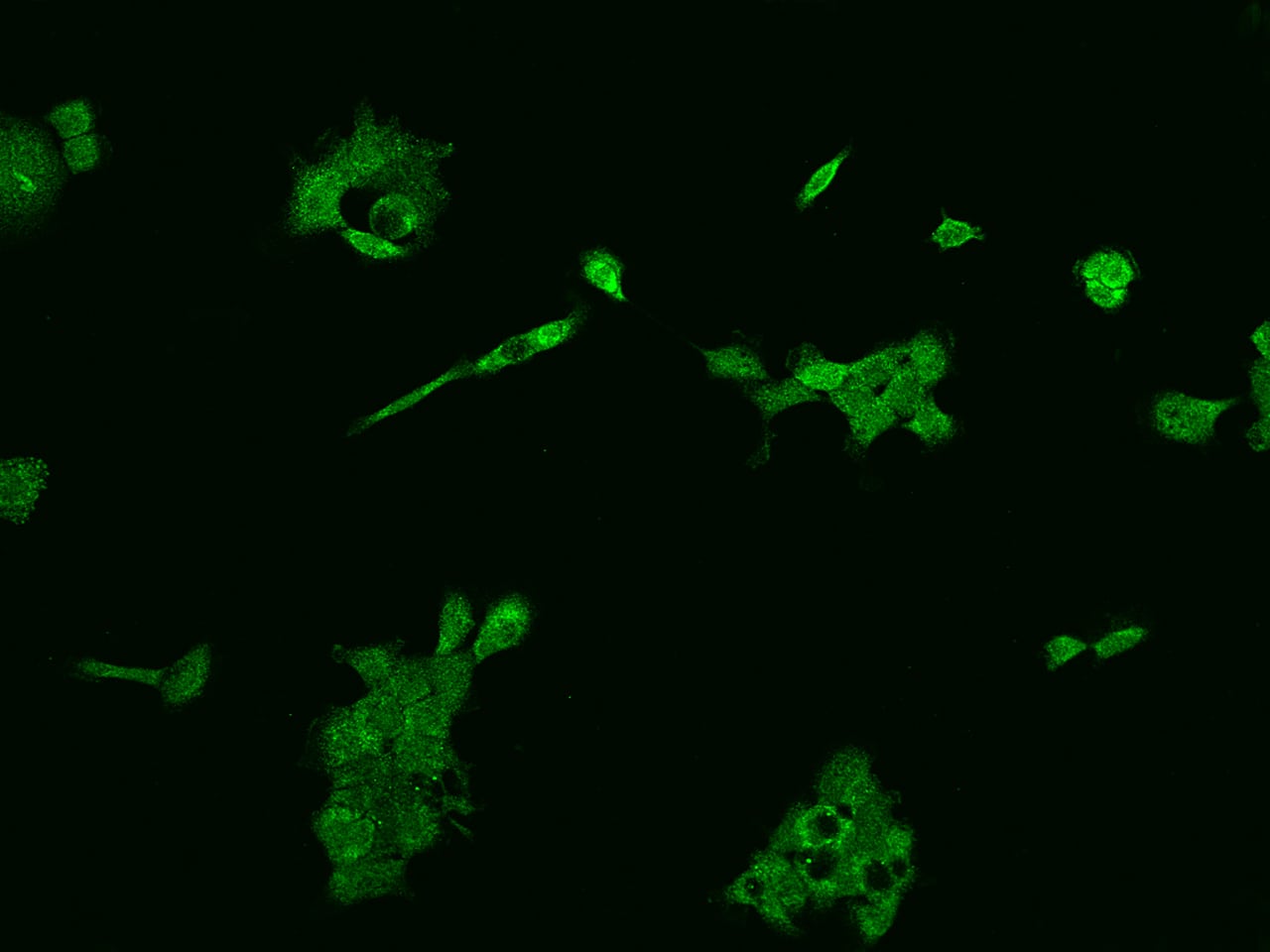 Immunocytochemistry/Immunofluorescence: SLC36A4 Antibody [NBP2-98630] - Immunofluorescence staining of SLC36A4 in A431 cells. Cells were fixed with 4% PFA, permeabilzed with 0.1% Triton X-100 in PBS, blocked with 10% serum, and incubated with NBP2-98630 antibody (dilution ratio 1:200) at 4C overnight. Then cells were stained with the Alexa Fluor(R)488-conjugated Goat Anti-rabbit IgG secondary antibody (green). Positive staining was localized to Cytoplasm.