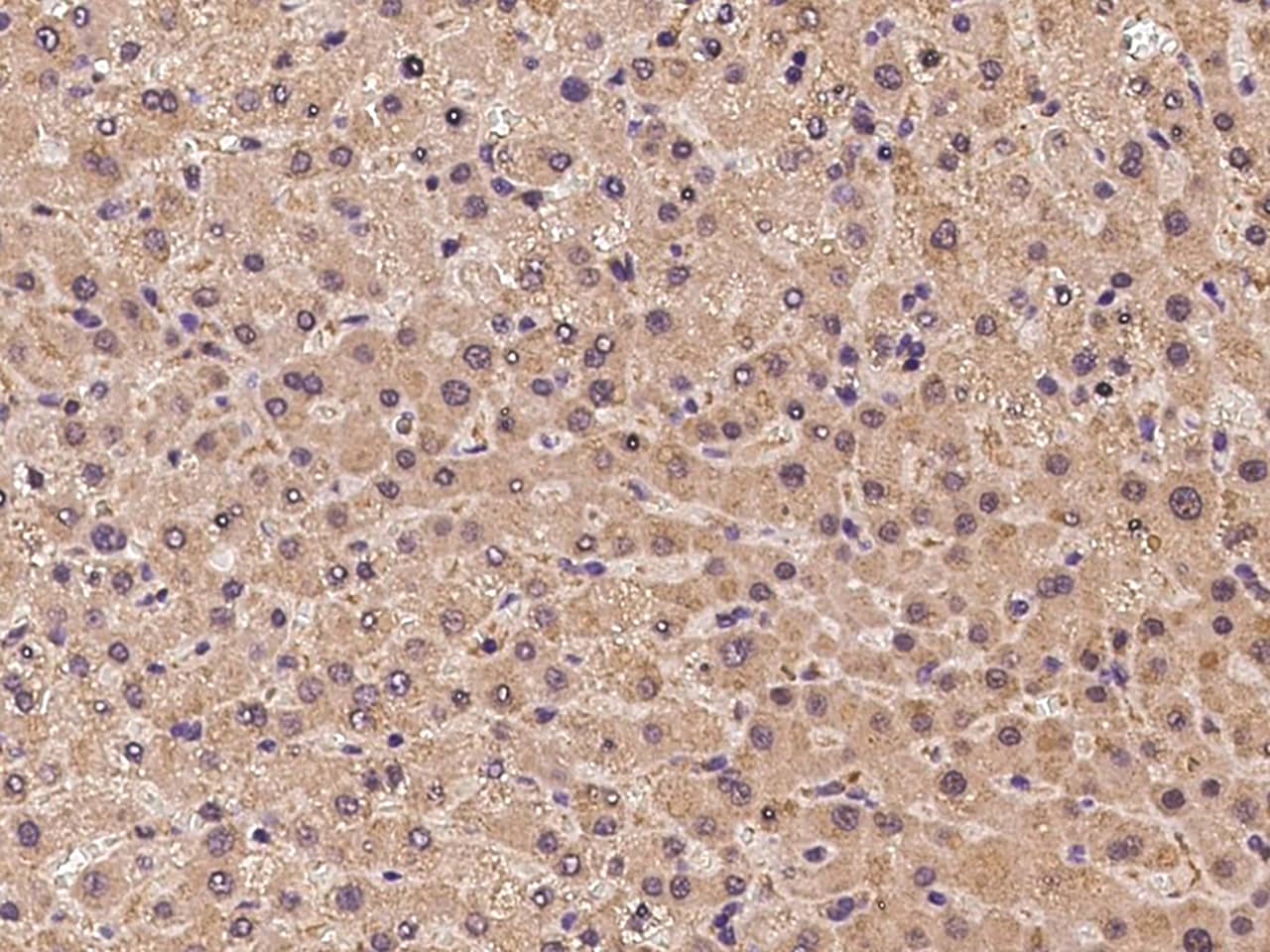 Immunohistochemistry-Paraffin: USP32 Antibody - BSA Free [NBP2-98655] - Immunochemical staining of human USP32 in human liver with NBP2-98655 at 1:100 dilution, formalin-fixed paraffin embedded sections.