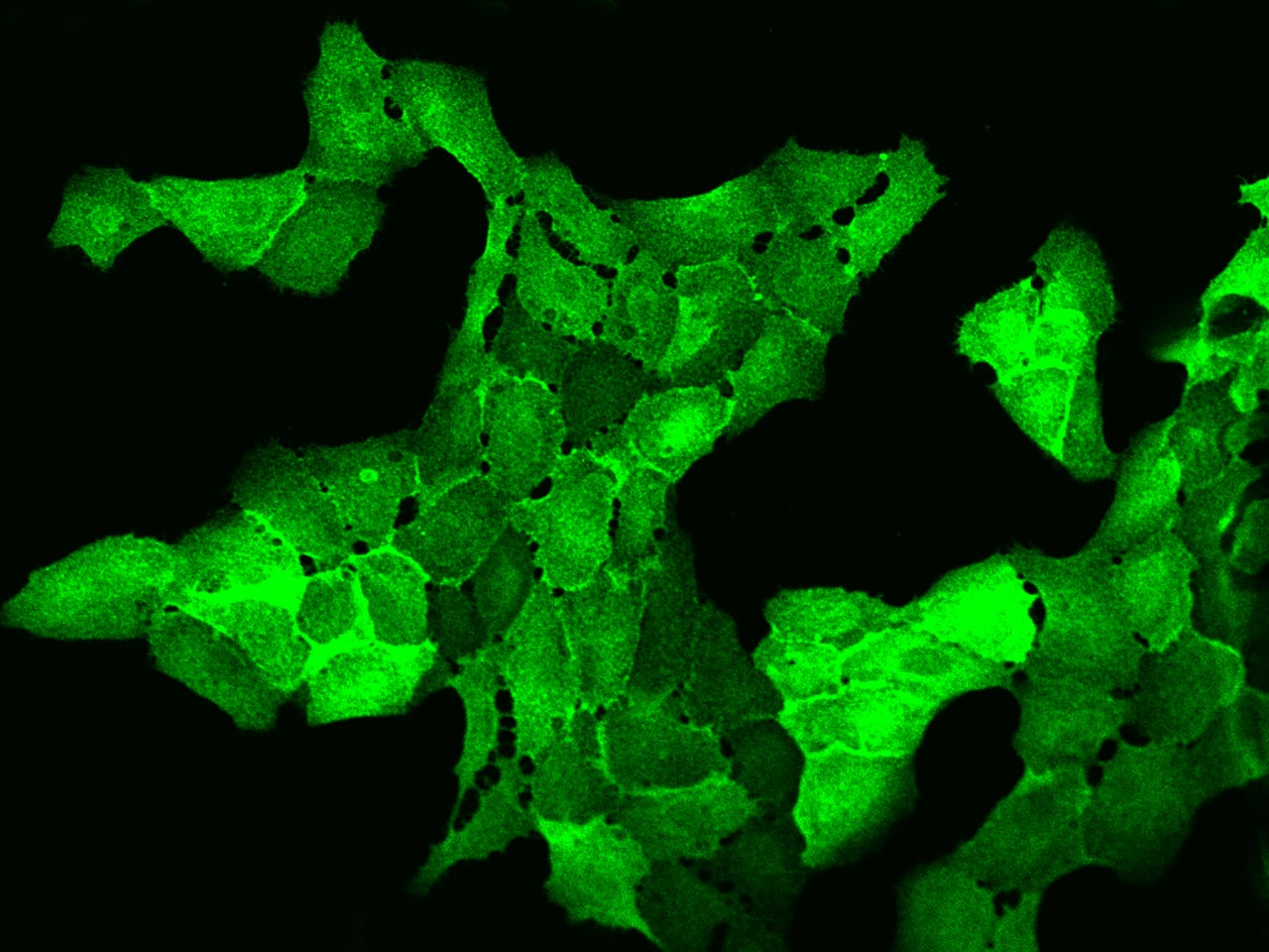 Immunocytochemistry/Immunofluorescence: AHNAK2 Antibody [NBP2-98657] - Immunofluorescence staining of AHNAK2 in U2OS cells. Cells were fixed with 4% PFA, permeabilzed with 0.1% Triton X-100 in PBS, blocked with 10% serum, and incubated with NBP2-98657 antibody (dilution ratio 1:200) at 4C overnight. Then cells were stained with the Alexa Fluor(R)488-conjugated Goat Anti-rabbit IgG Secondary antibody (green). Positive staining was localized to Cytoplasm and cell membrane.