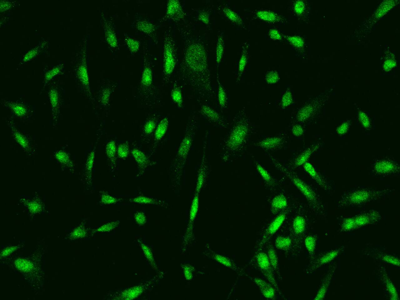 Immunocytochemistry/Immunofluorescence: Aprataxin Antibody [NBP2-98661] - Immunofluorescence staining of Aprataxin in PC3 cells. Cells were fixed with 4% PFA, permeabilzed with 0.1% Triton X-100 in PBS, blocked with 10% serum, and incubated with NBP2-98661 antibody (dilution ratio 1:200) at 4C overnight. Then cells were stained with the Alexa Fluor(R)488-conjugated Goat Anti-rabbit IgG Secondary antibody (green). Positive staining was localized to Nucleus.