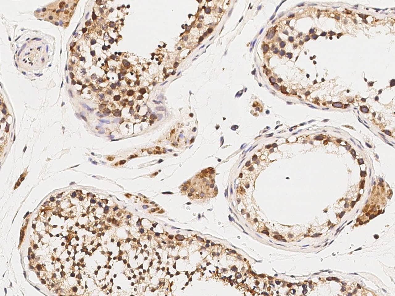 Immunohistochemistry-Paraffin: STRA8 Antibody [NBP2-98691] - Immunochemical staining of human STRA8 in human testis with NBP2-98691 (1:500, formalin-fixed paraffin embedded sections).