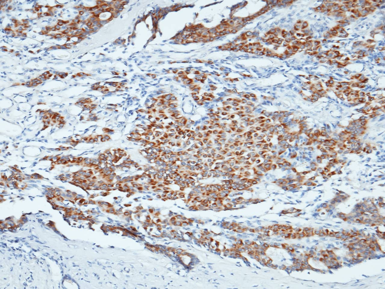 Immunohistochemistry-Paraffin NANOS1 Antibody - Azide and BSA Free
